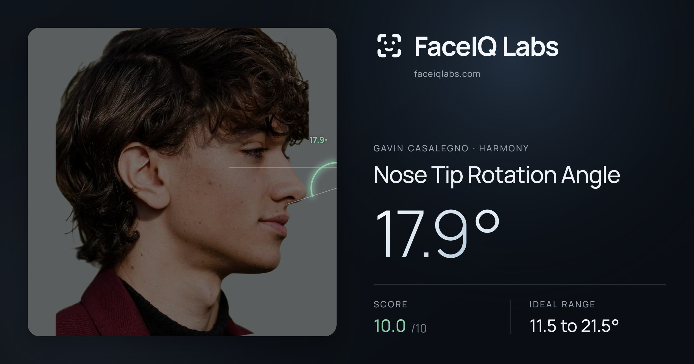 Gavin Casalegno Nose Tip Rotation Angle: 17.9°, drawn on the photo