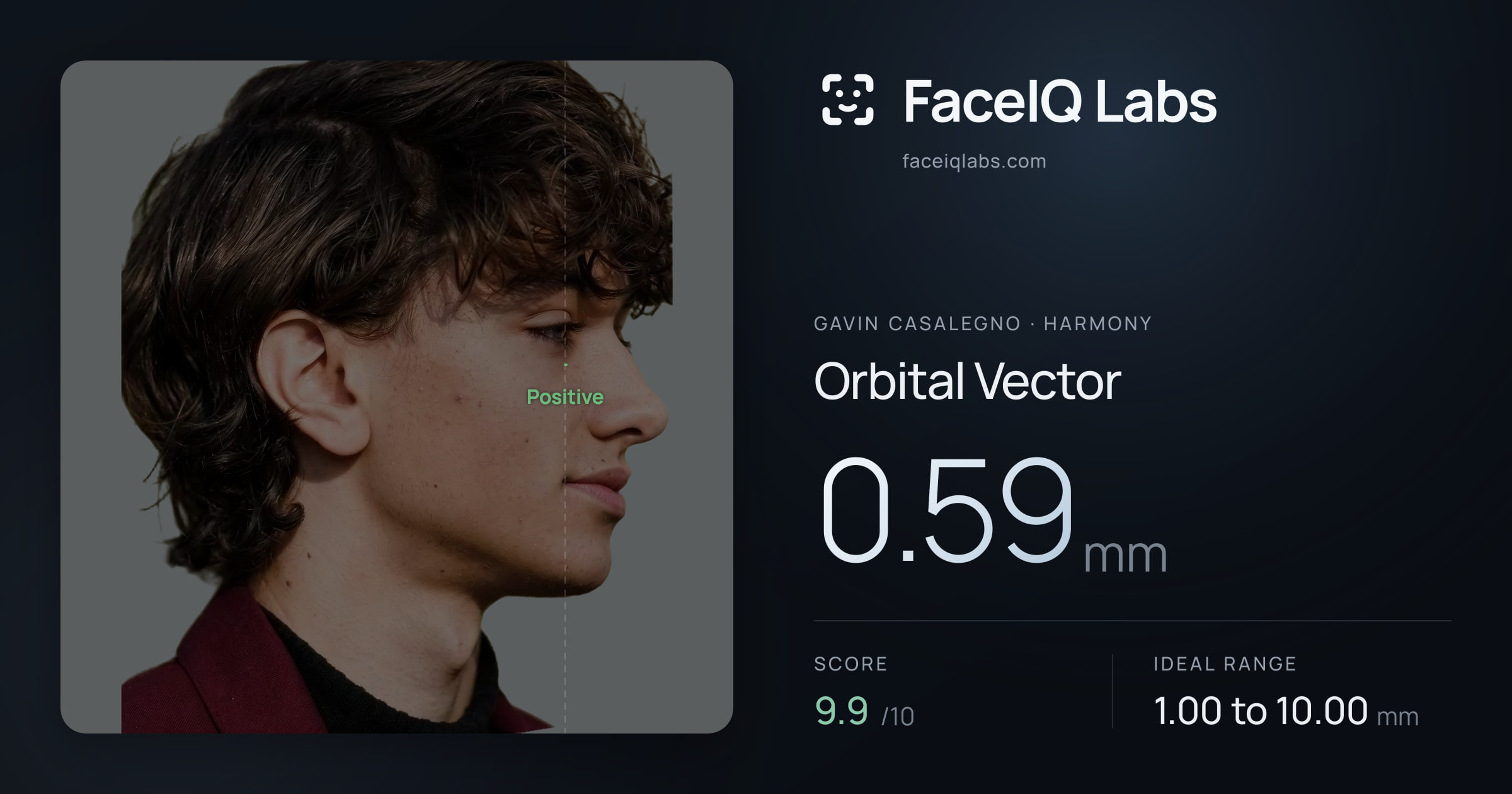 Gavin Casalegno Orbital Vector: 0.59mm, drawn on the photo