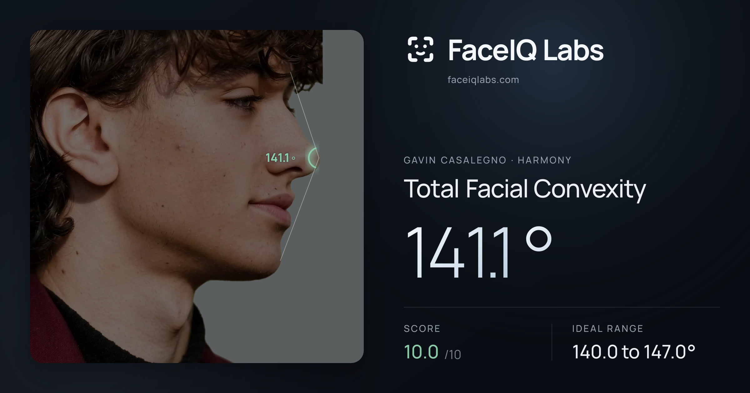 Gavin Casalegno Total Facial Convexity: 141.1°, drawn on the photo
