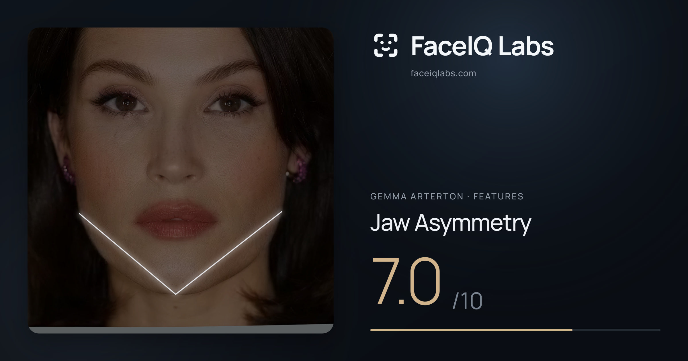 Gemma Arterton Jaw Asymmetry: 7.0/10, drawn on the photo