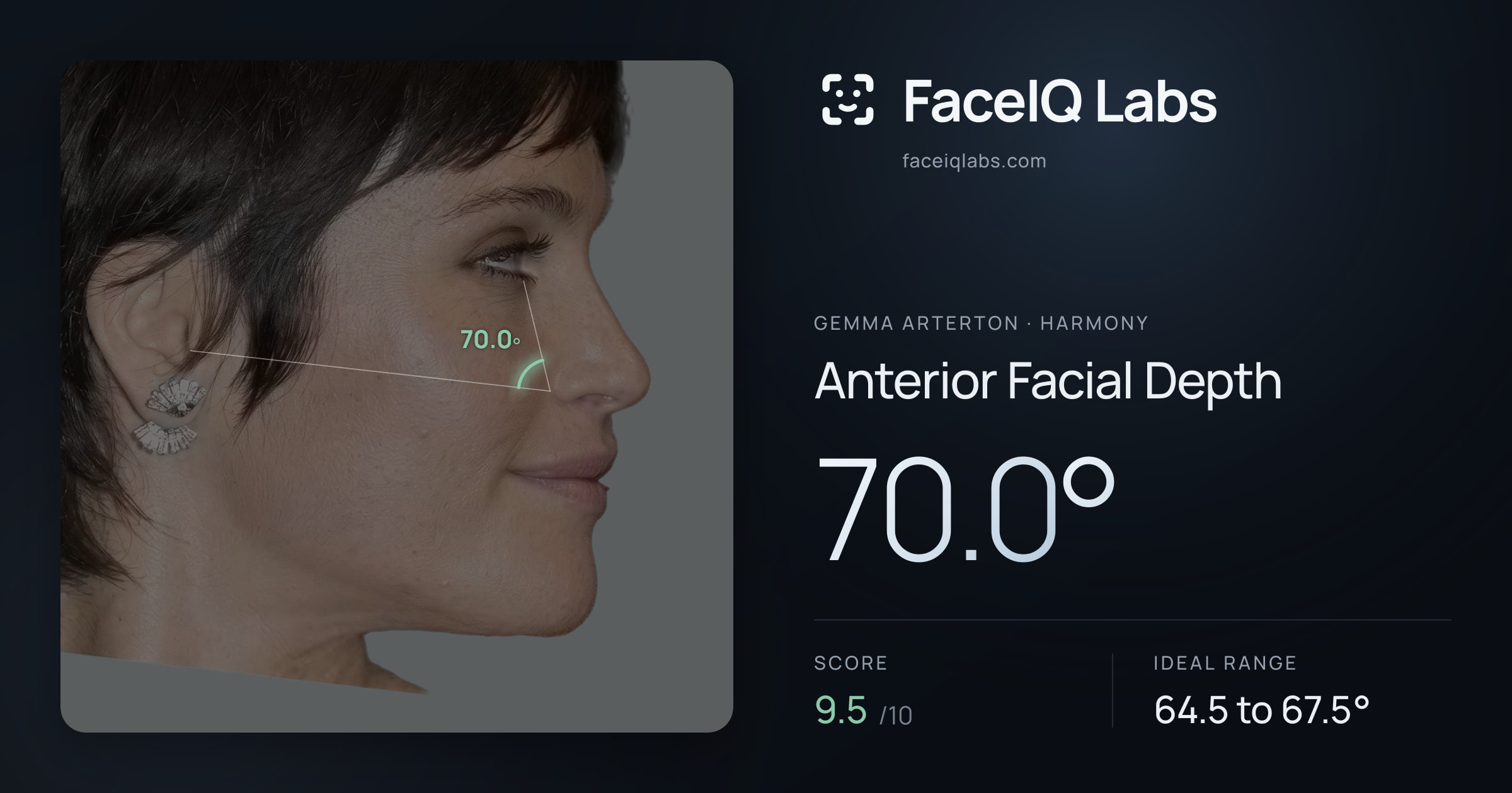 Gemma Arterton Anterior Facial Depth: 70.0°, drawn on the photo