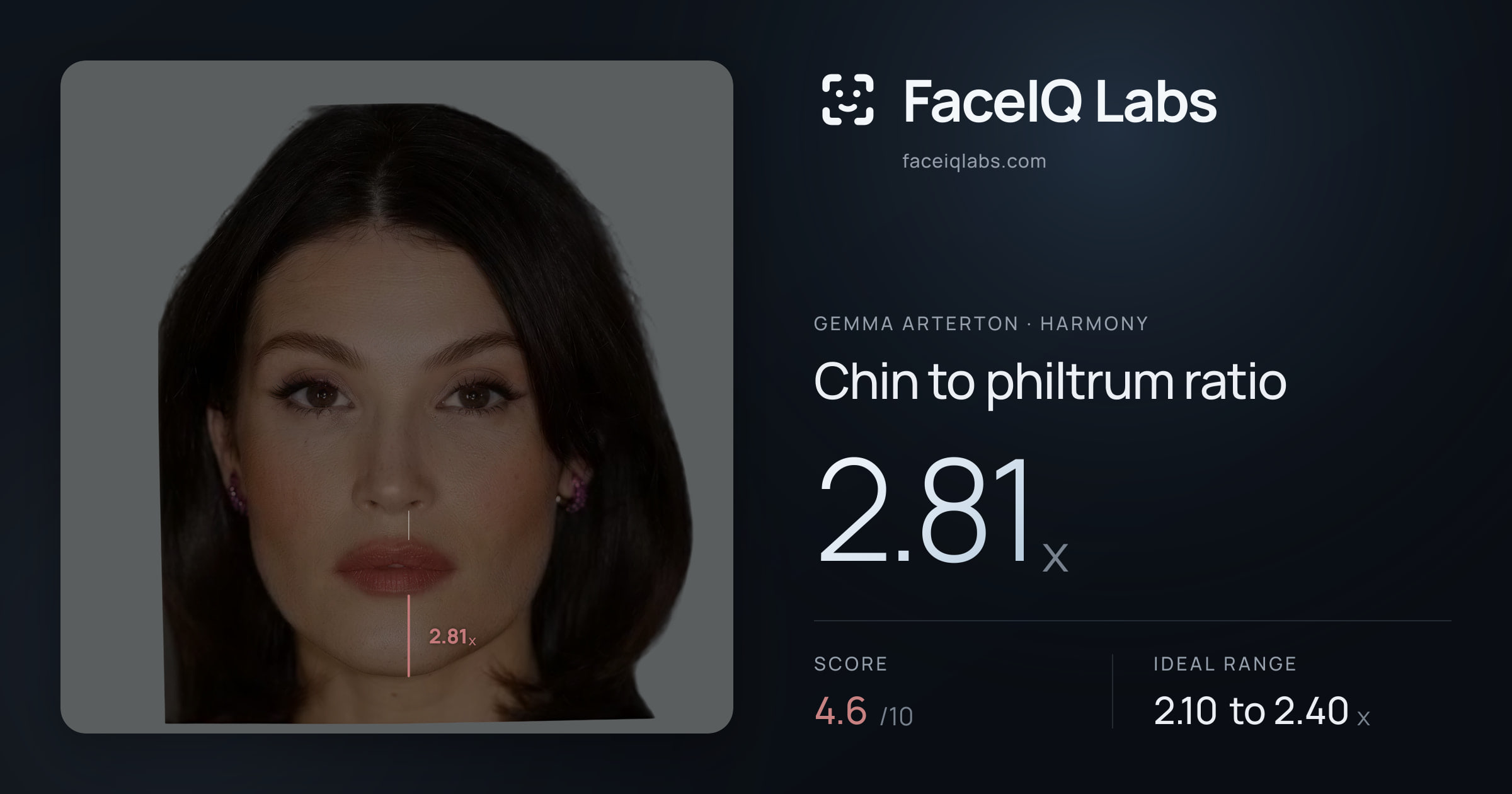 Gemma Arterton Chin to philtrum ratio: 2.81x, drawn on the photo
