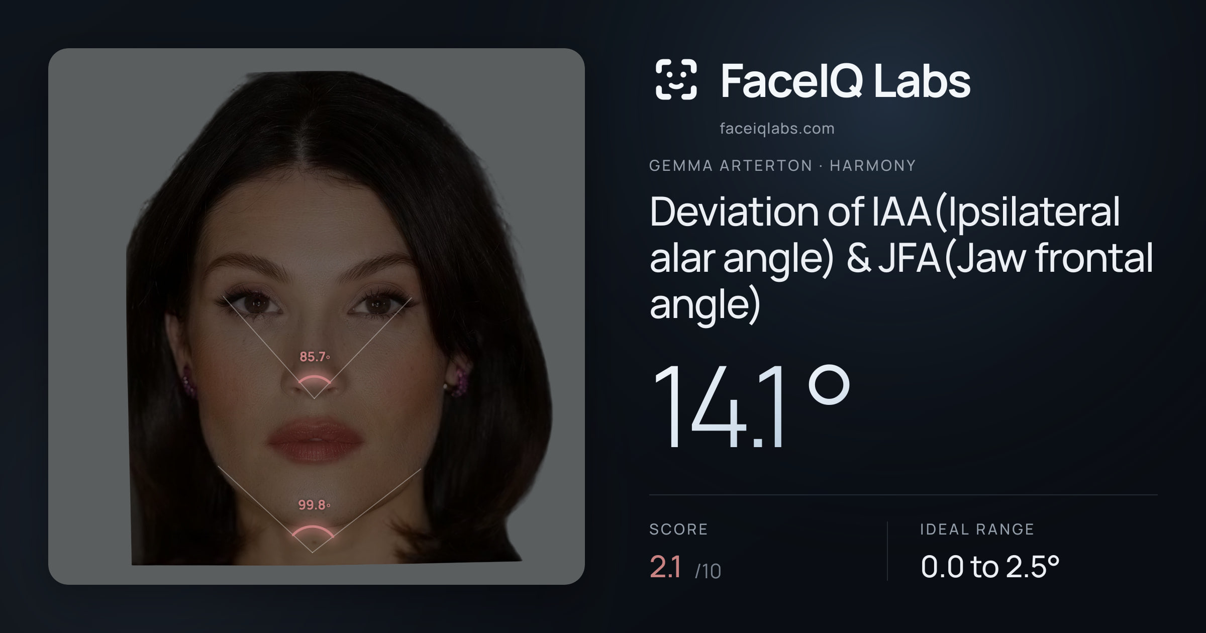Gemma Arterton Deviation of IAA(Ipsilateral alar angle) & JFA(Jaw frontal angle): 14.1°, drawn on the photo