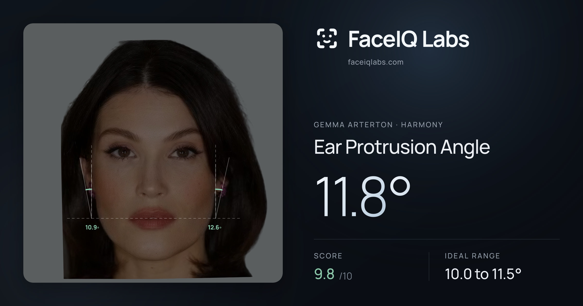 Gemma Arterton Ear Protrusion Angle: 11.8°, drawn on the photo