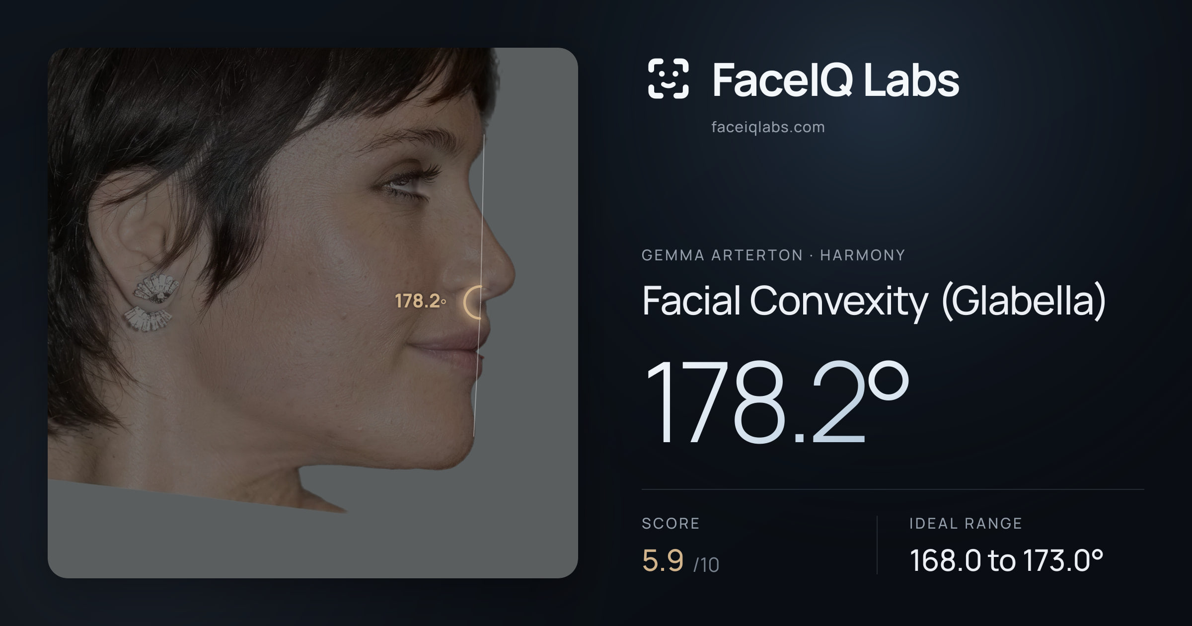 Gemma Arterton Facial Convexity (Glabella): 178.2°, drawn on the photo