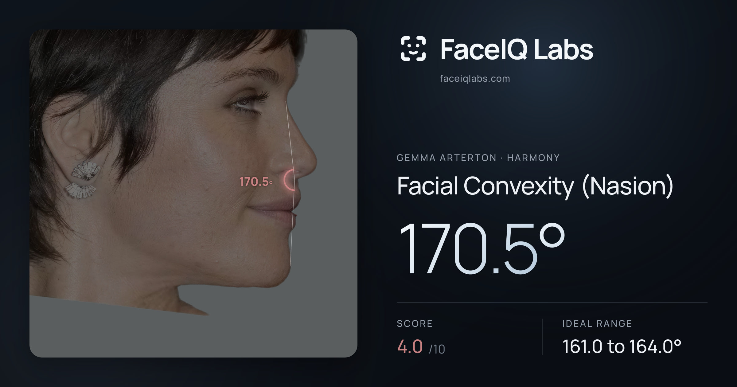 Gemma Arterton Facial Convexity (Nasion): 170.5°, drawn on the photo
