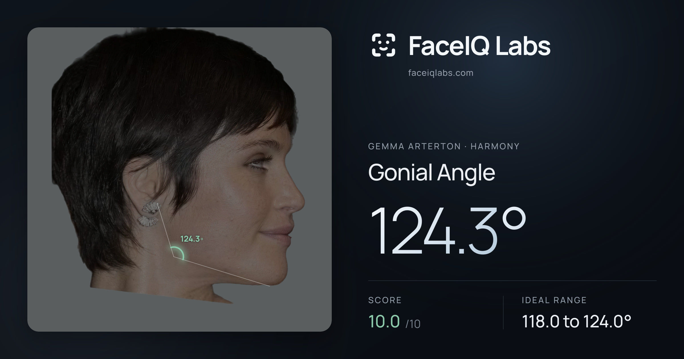 Gemma Arterton Gonial Angle: 124.3°, drawn on the photo