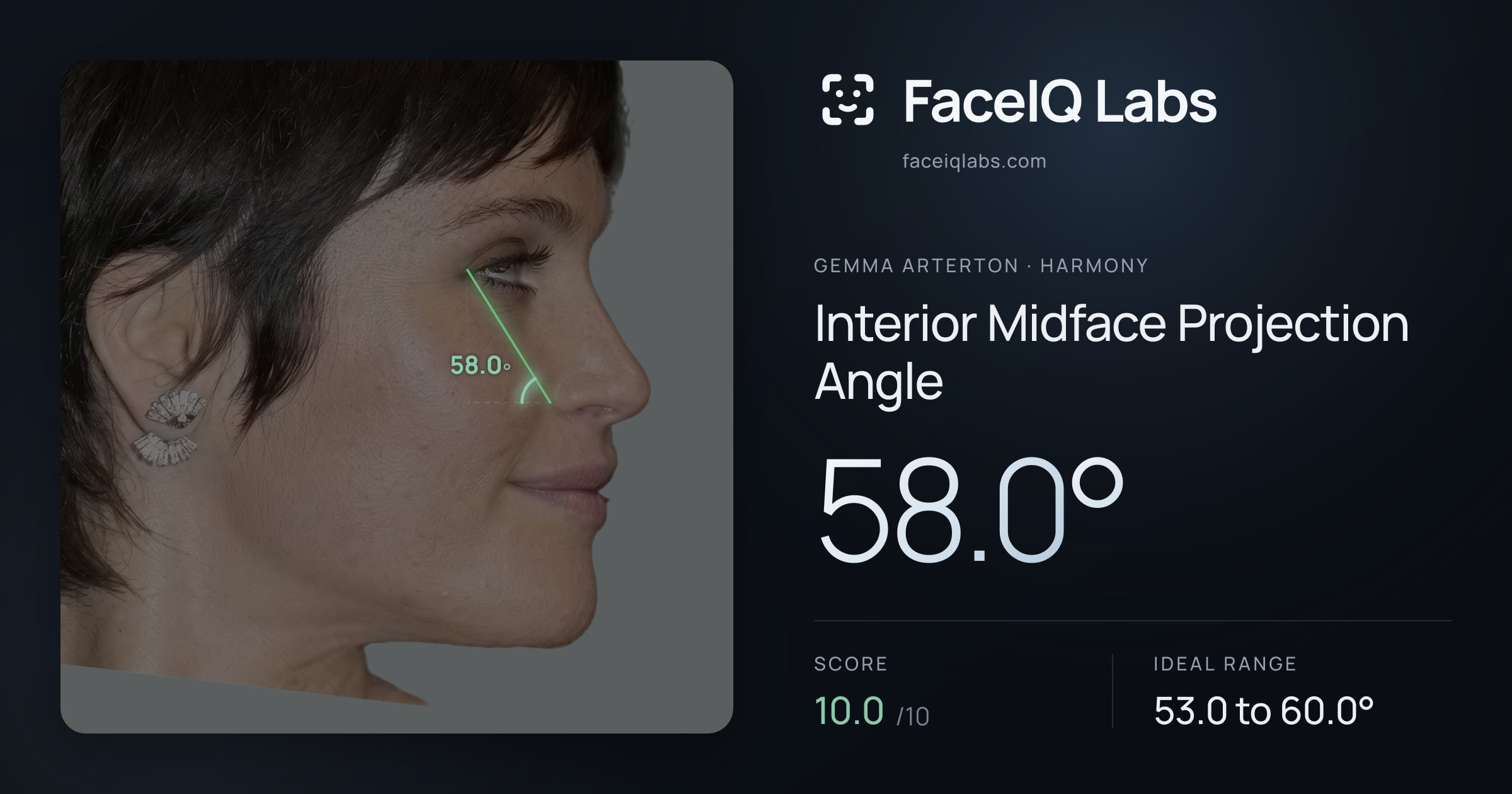 Gemma Arterton Interior Midface Projection Angle: 58.0°, drawn on the photo