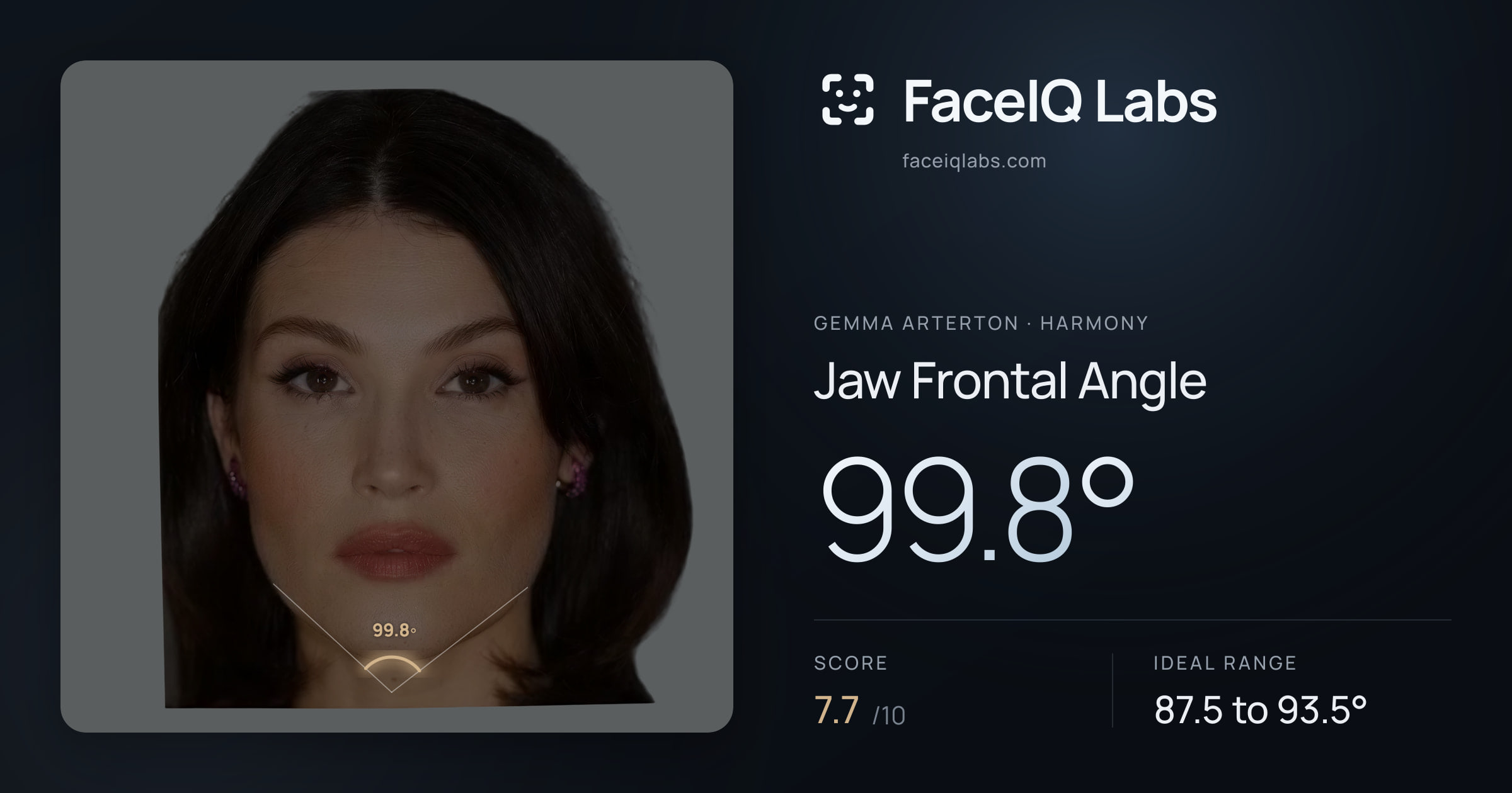 Gemma Arterton Jaw Frontal Angle: 99.8°, drawn on the photo