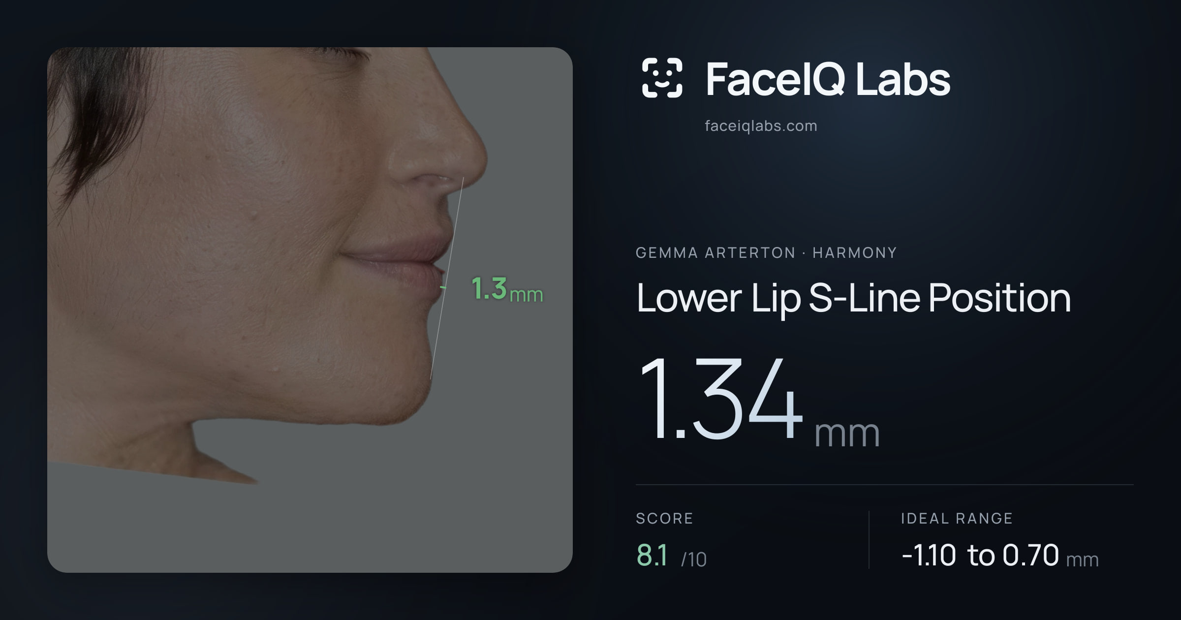 Gemma Arterton Lower Lip S-Line Position: 1.34mm, drawn on the photo