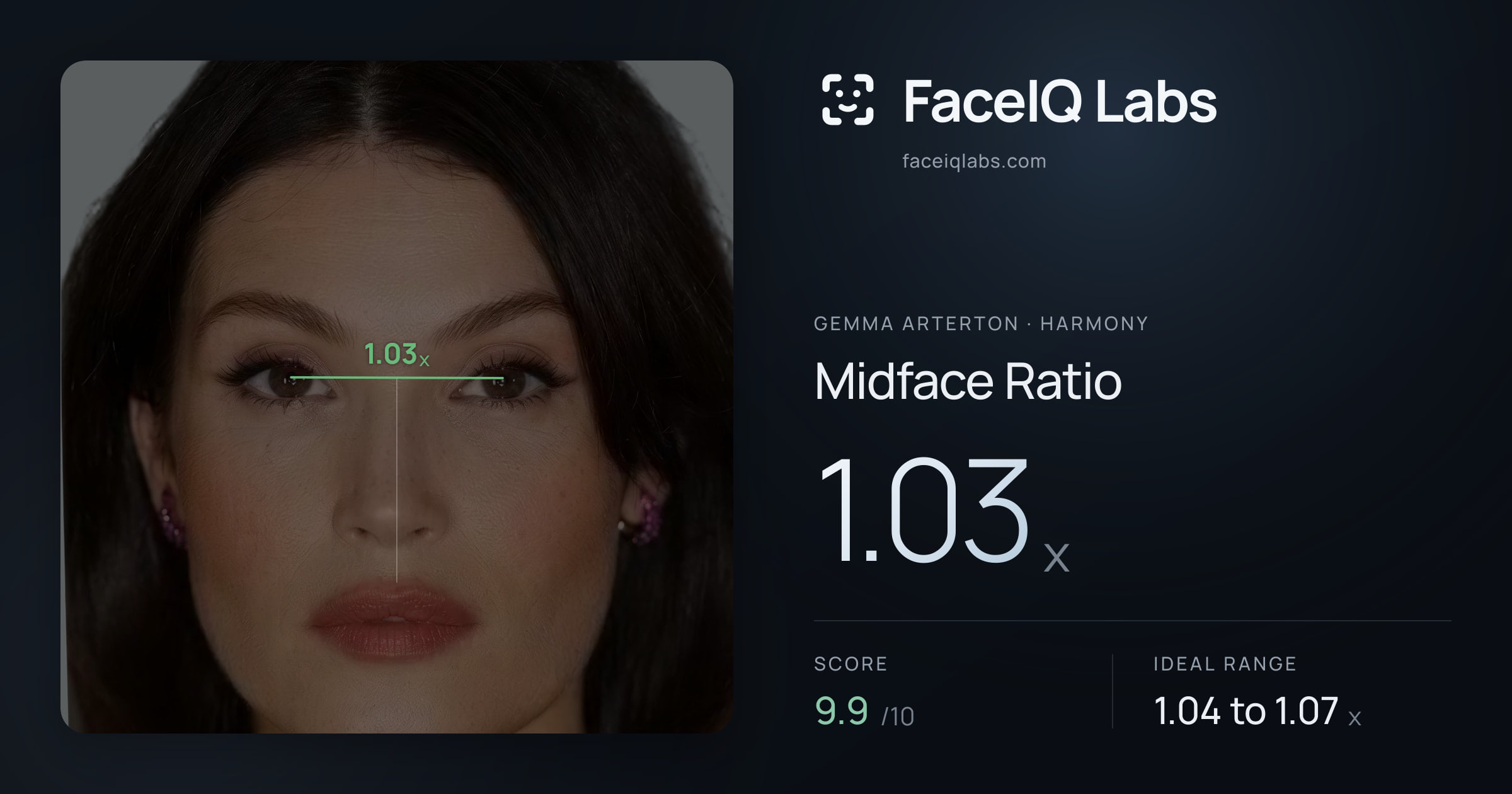 Gemma Arterton Midface Ratio: 1.03x, drawn on the photo