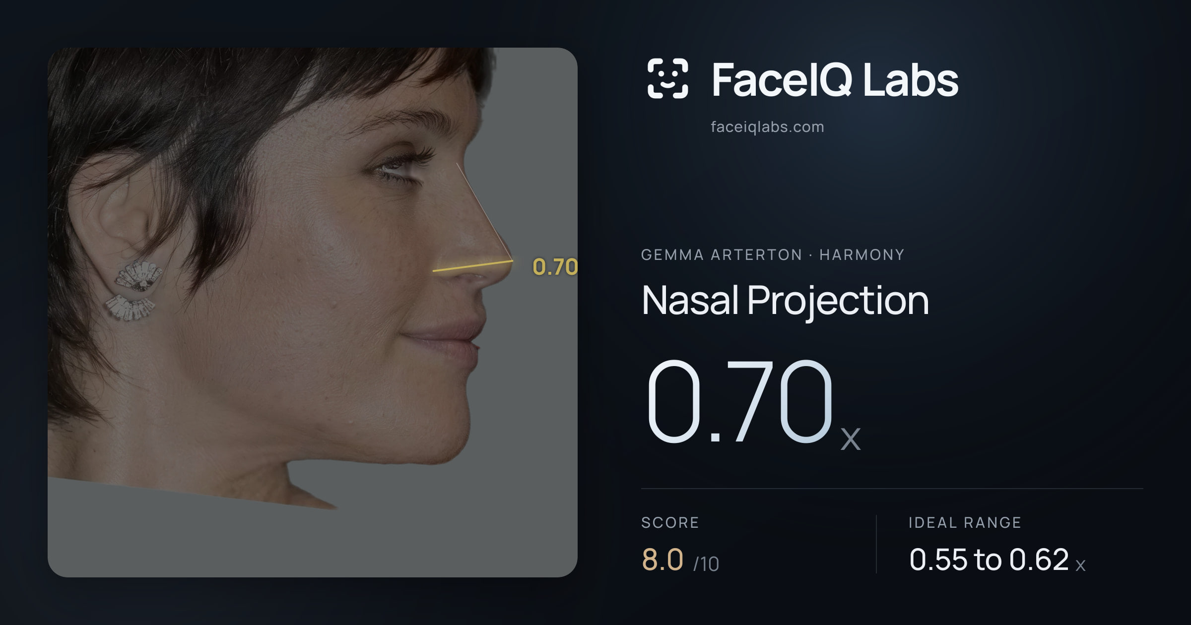 Gemma Arterton Nasal Projection: 0.70x, drawn on the photo
