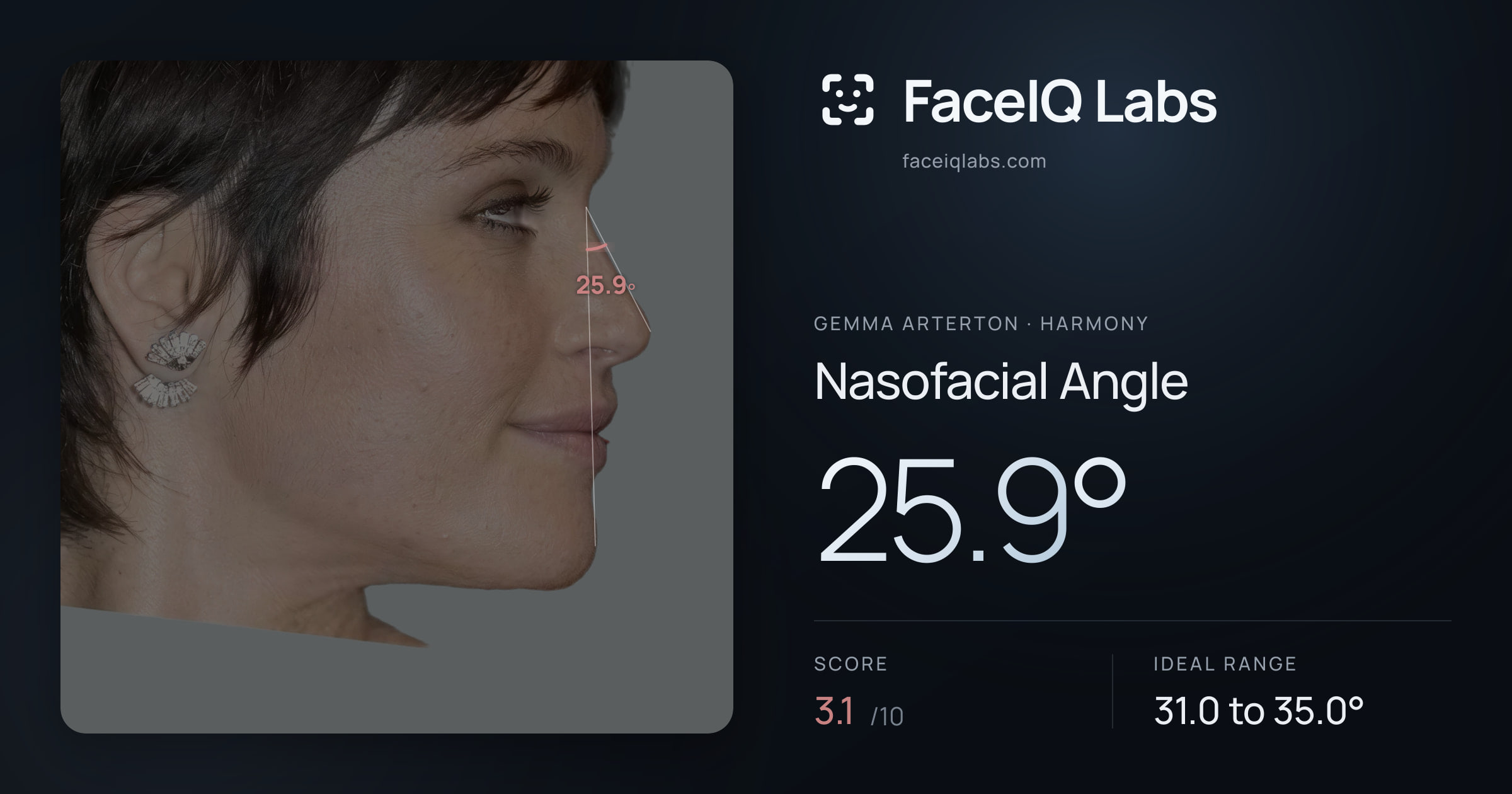 Gemma Arterton Nasofacial Angle: 25.9°, drawn on the photo