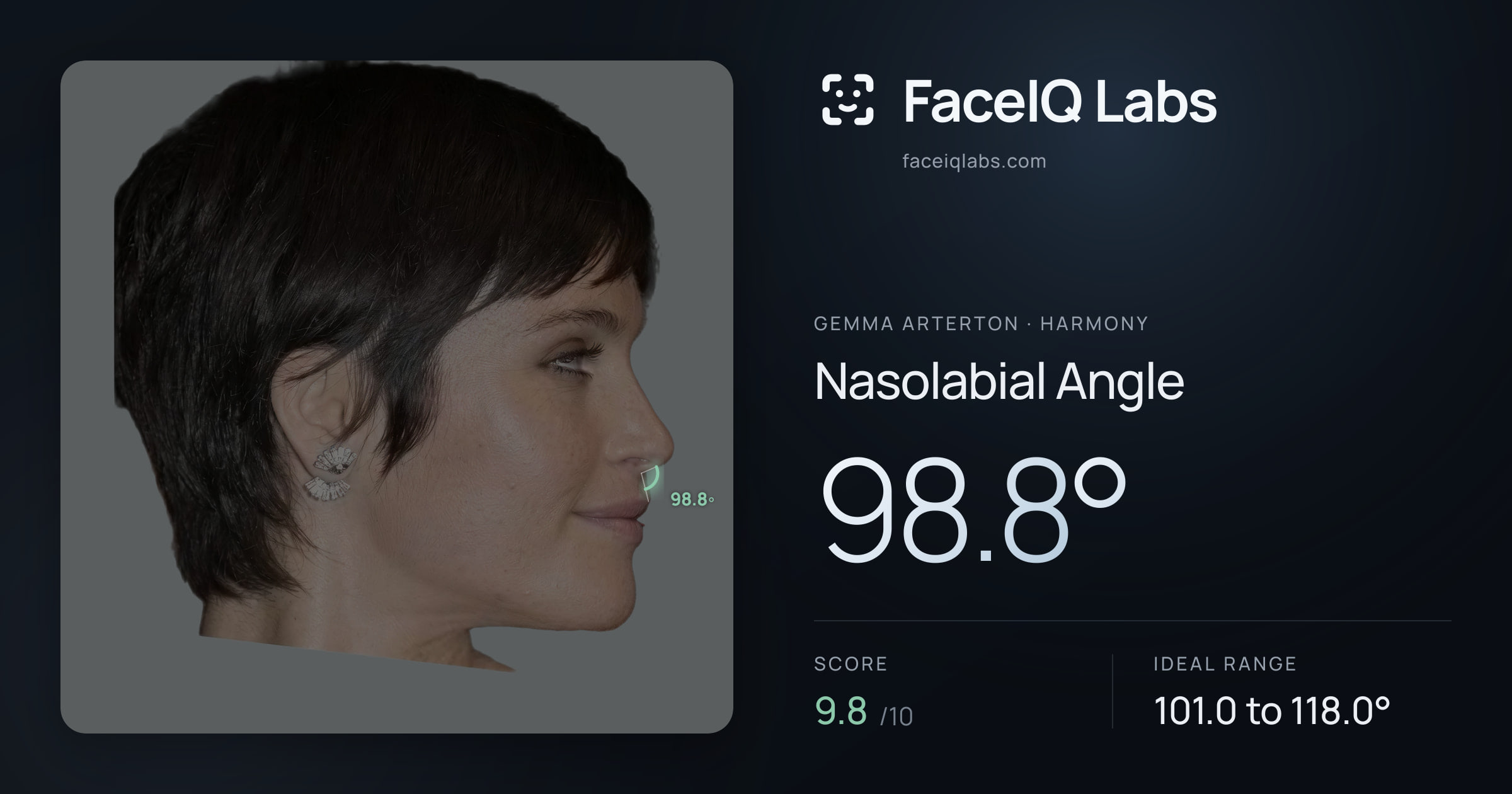 Gemma Arterton Nasolabial Angle: 98.8°, drawn on the photo