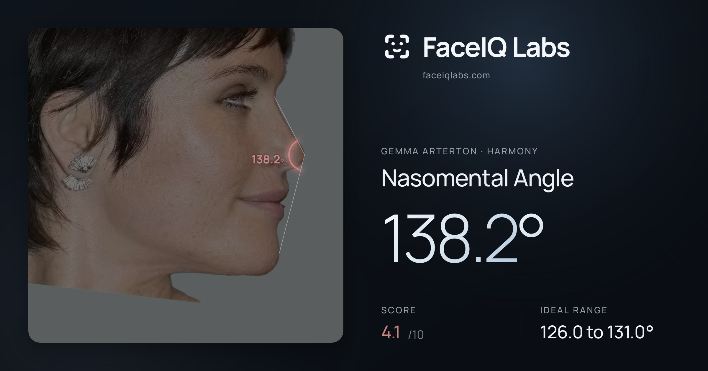 Gemma Arterton Nasomental Angle: 138.2°, drawn on the photo