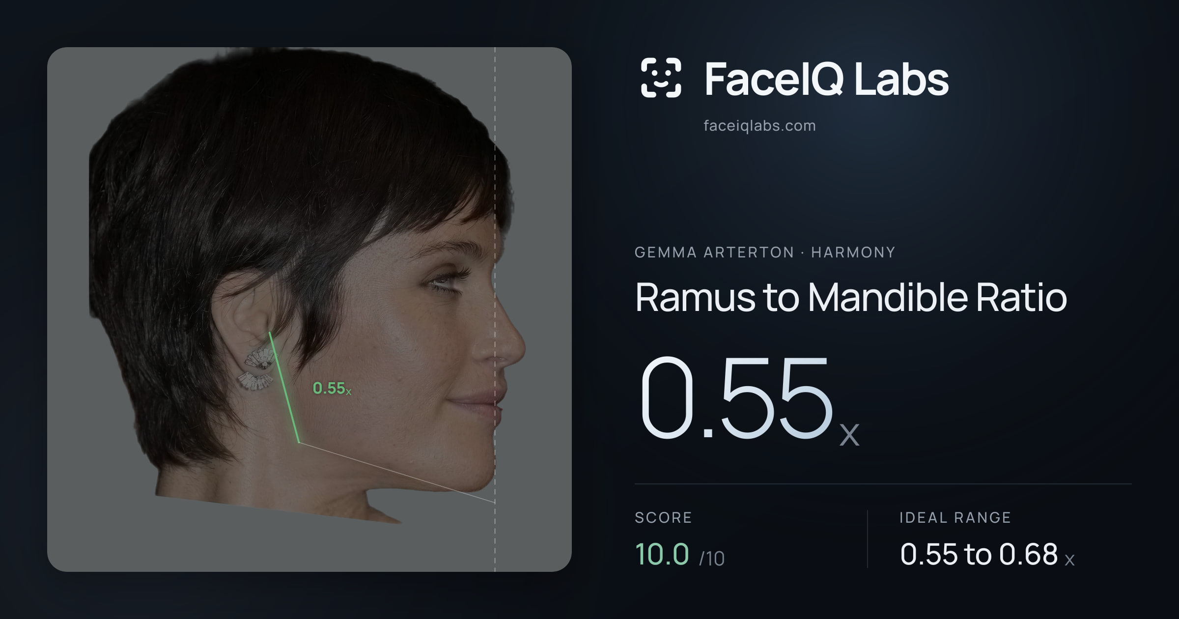 Gemma Arterton Ramus to Mandible Ratio: 0.55x, drawn on the photo