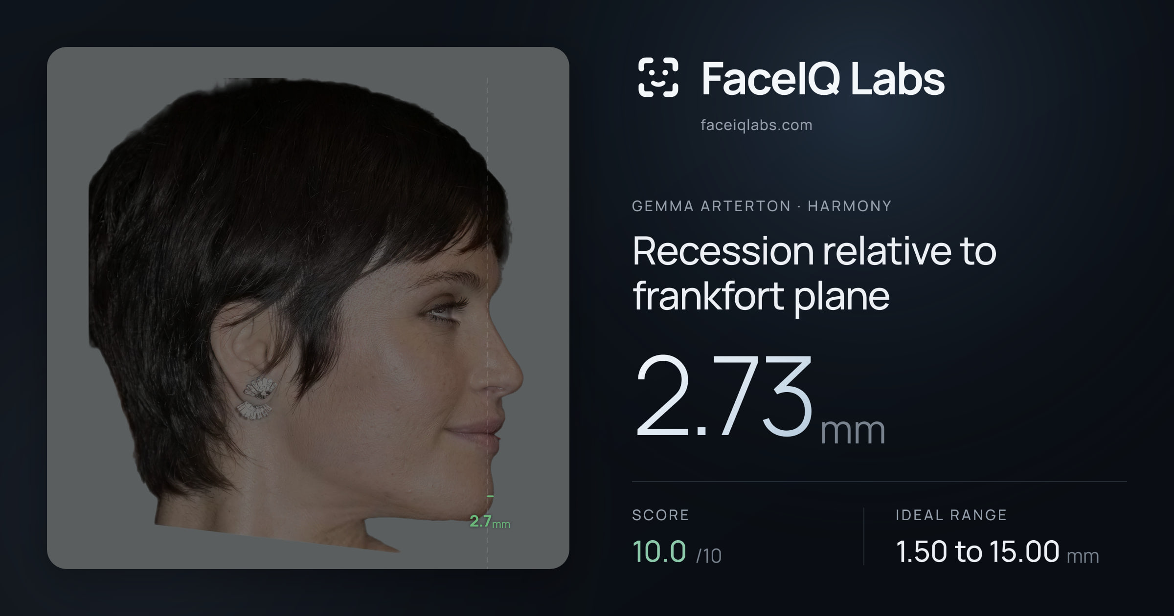 Gemma Arterton Recession relative to frankfort plane: 2.73mm, drawn on the photo