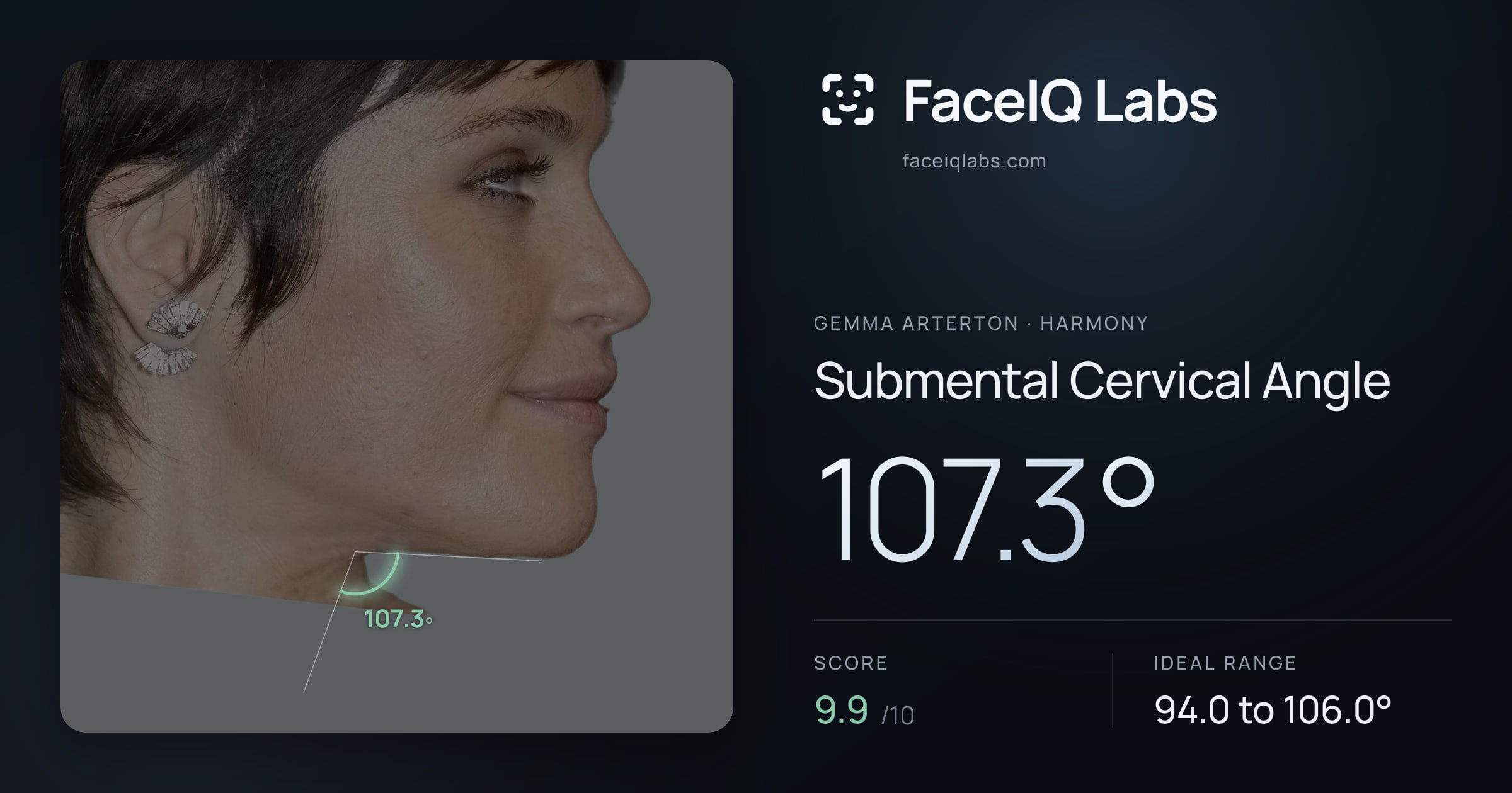 Gemma Arterton Submental Cervical Angle: 107.3°, drawn on the photo