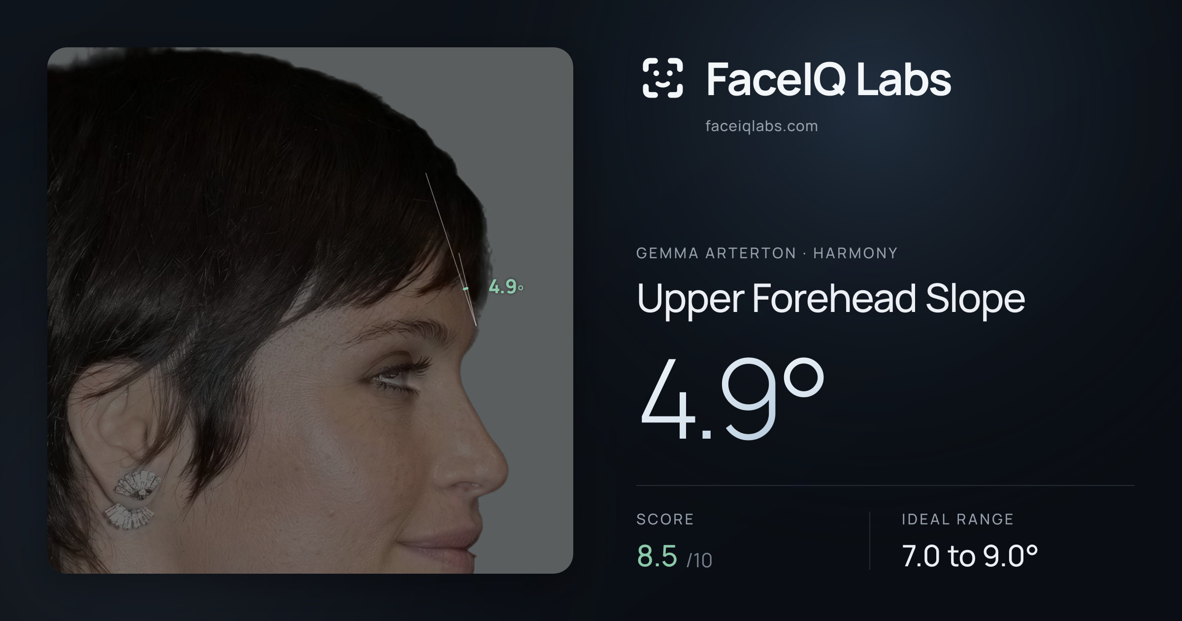 Gemma Arterton Upper Forehead Slope: 4.9°, drawn on the photo