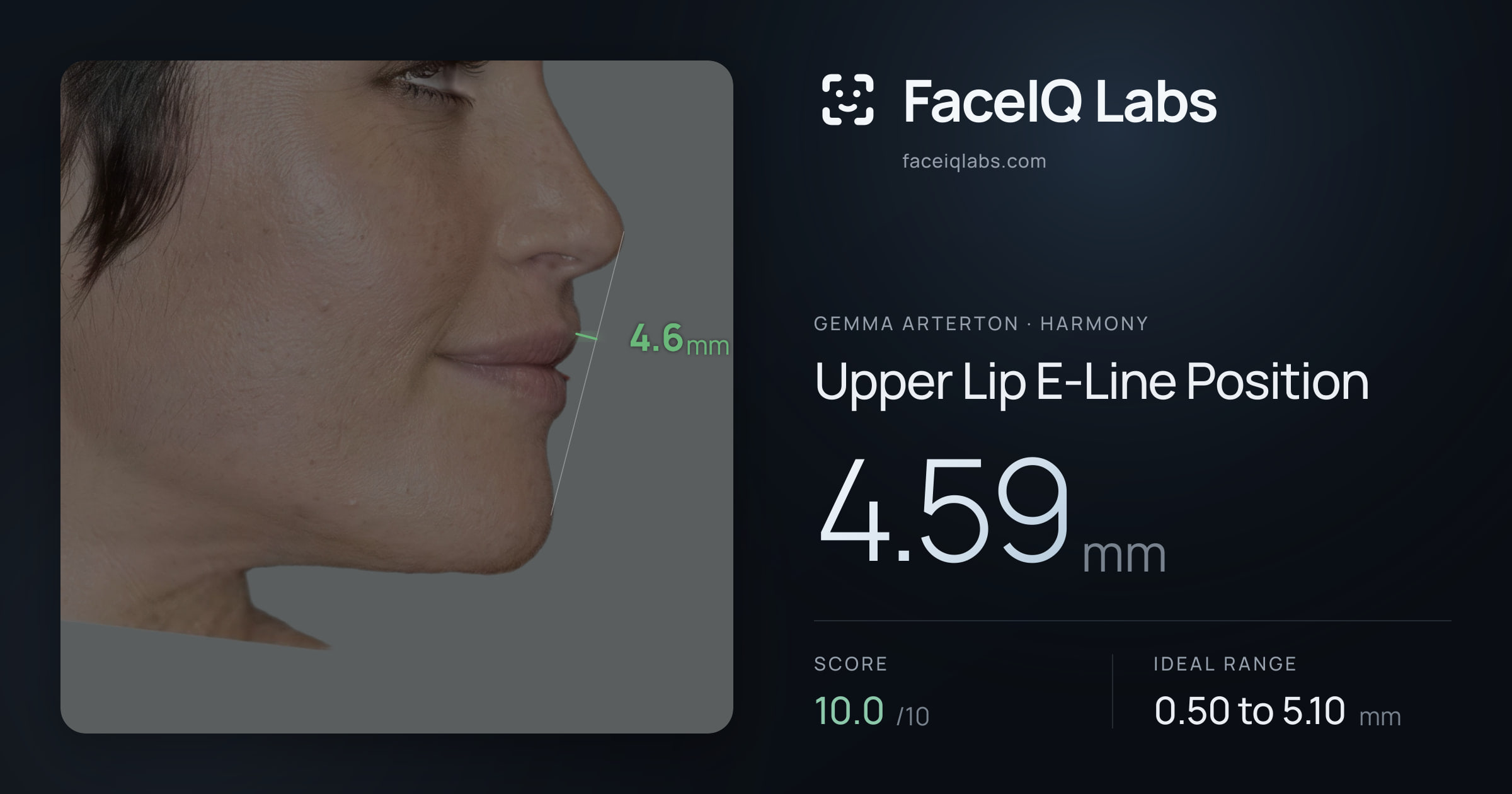 Gemma Arterton Upper Lip E-Line Position: 4.59mm, drawn on the photo