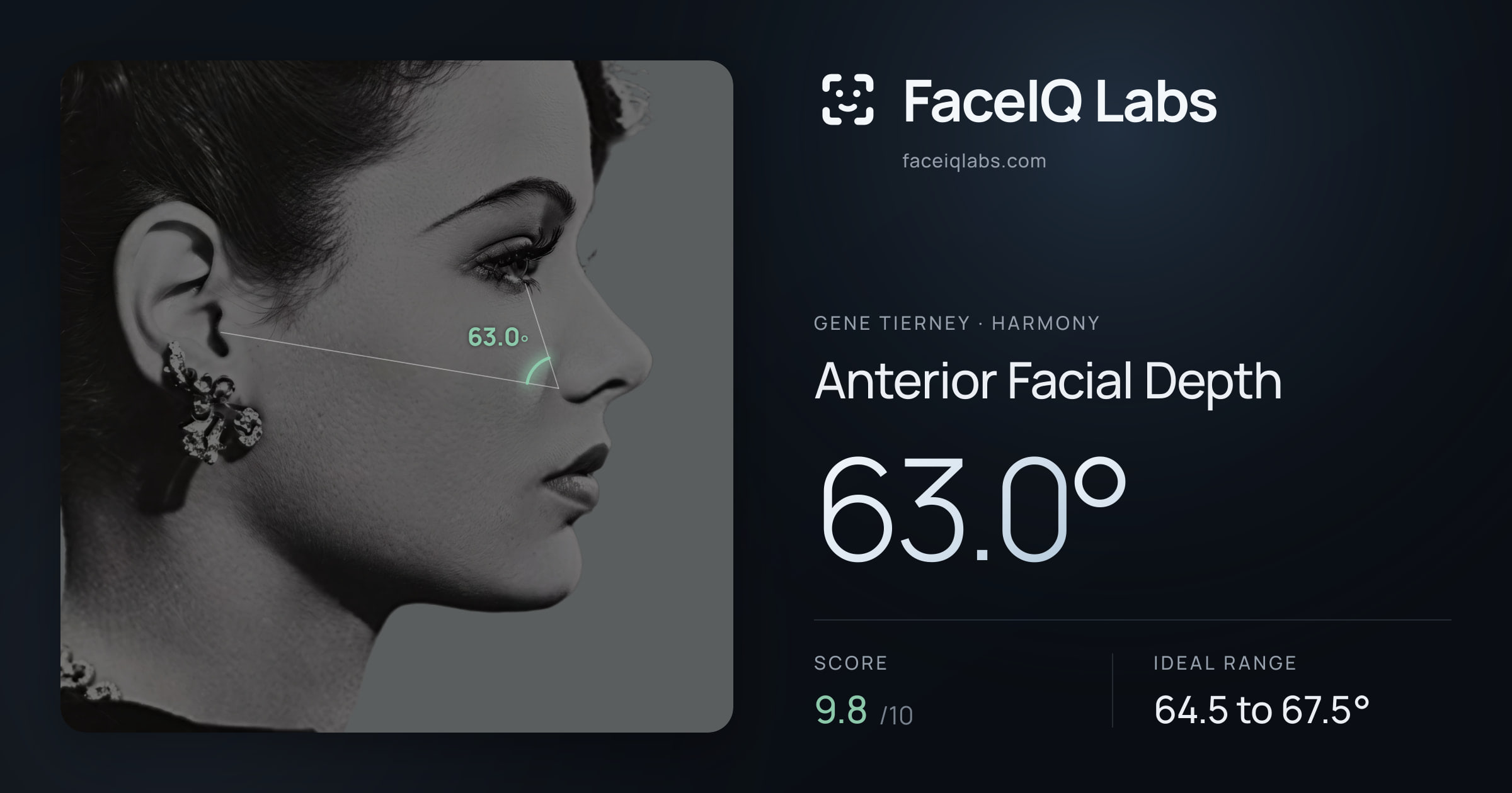 Gene Tierney Anterior Facial Depth: 63.0°, drawn on the photo