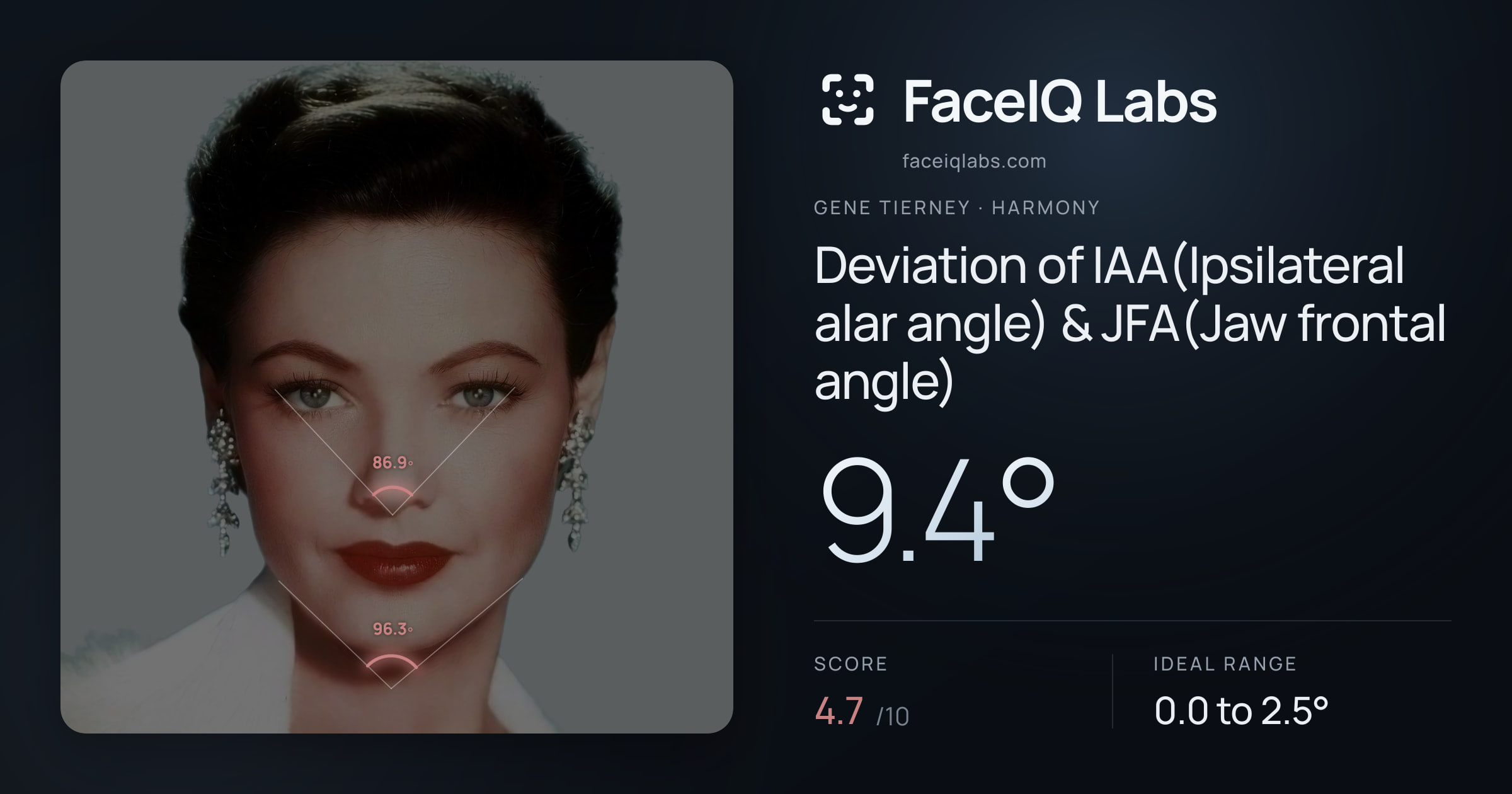 Gene Tierney Deviation of IAA(Ipsilateral alar angle) & JFA(Jaw frontal angle): 9.4°, drawn on the photo