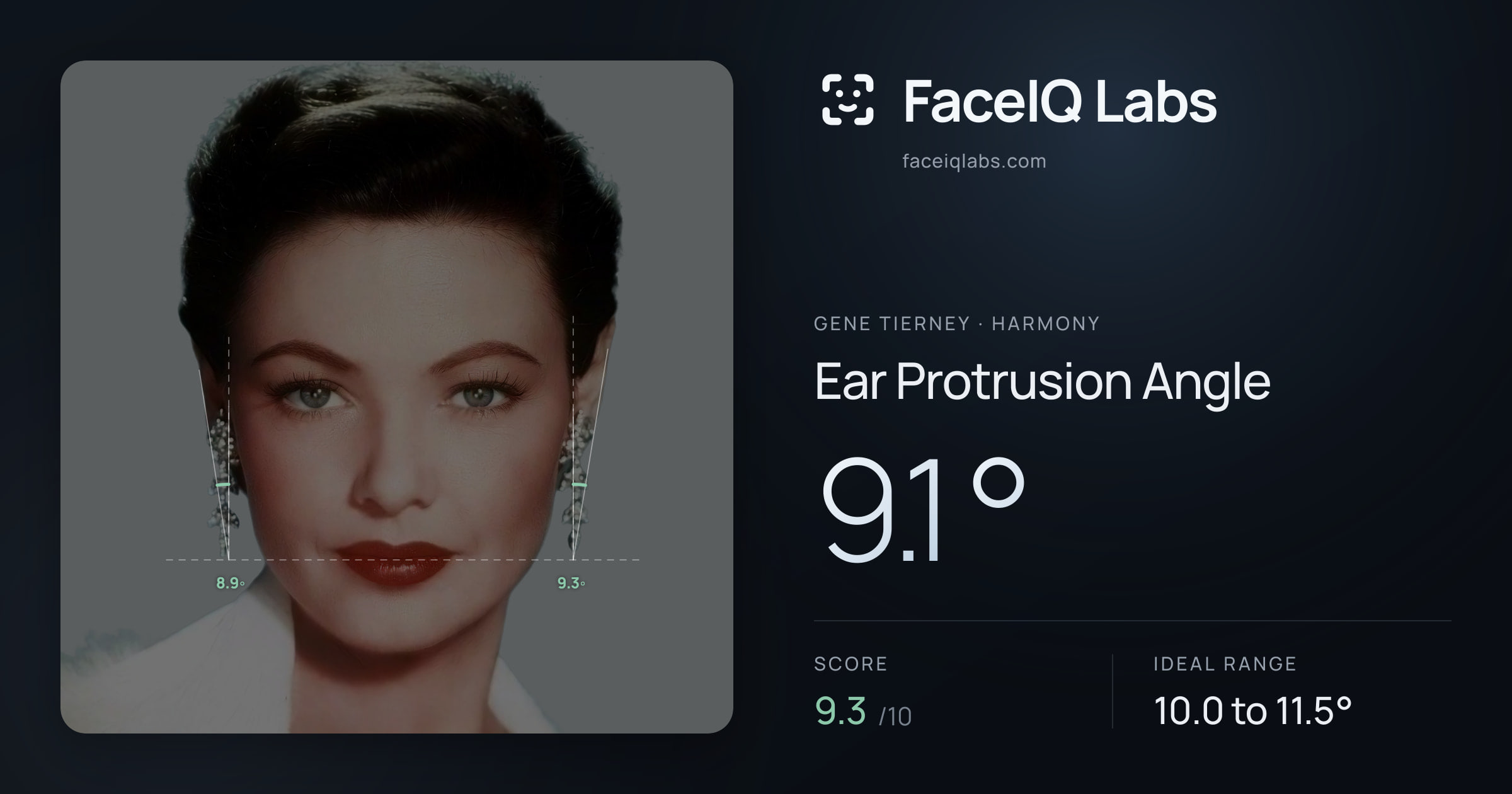 Gene Tierney Ear Protrusion Angle: 9.1°, drawn on the photo
