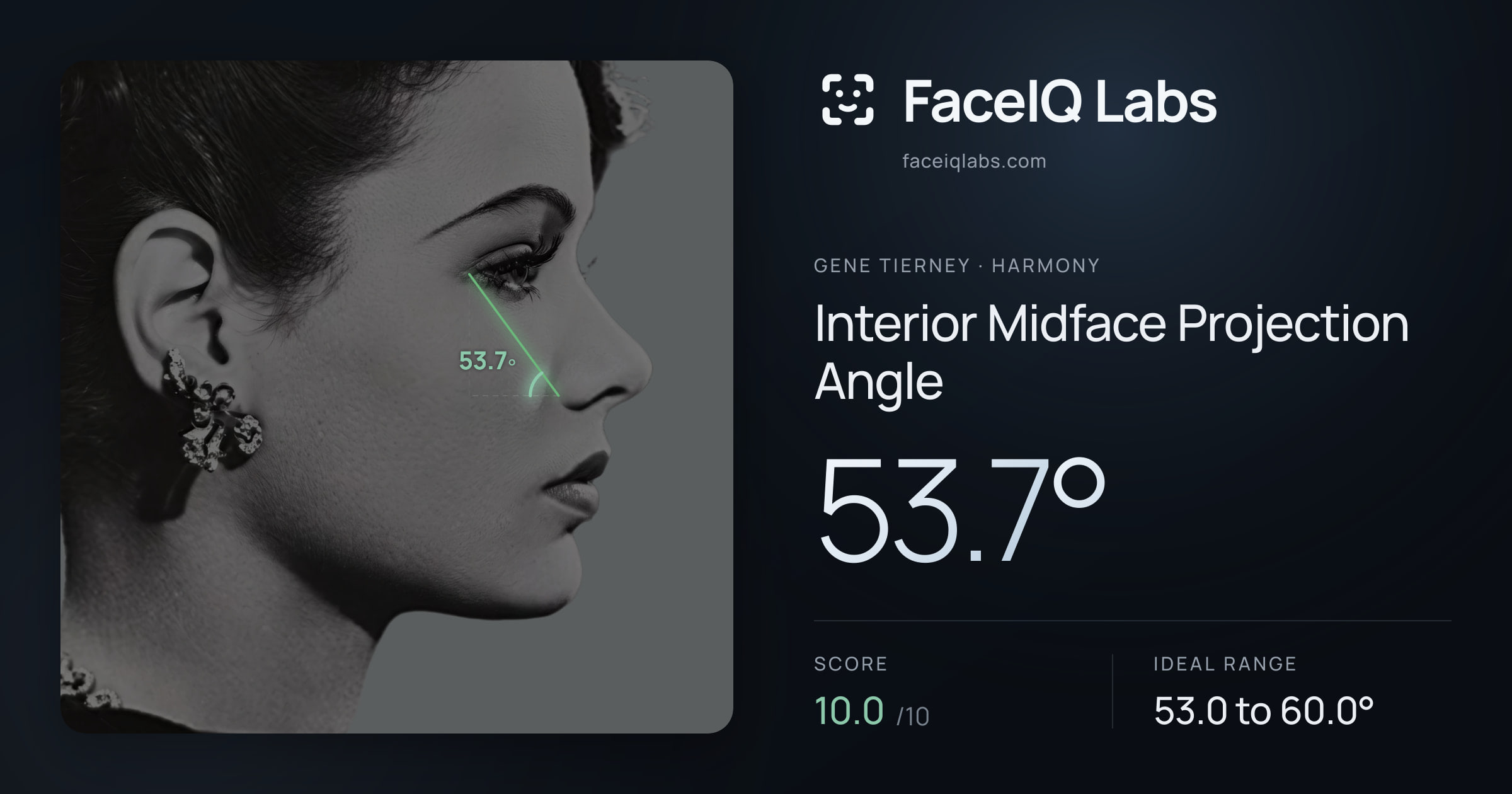 Gene Tierney Interior Midface Projection Angle: 53.7°, drawn on the photo
