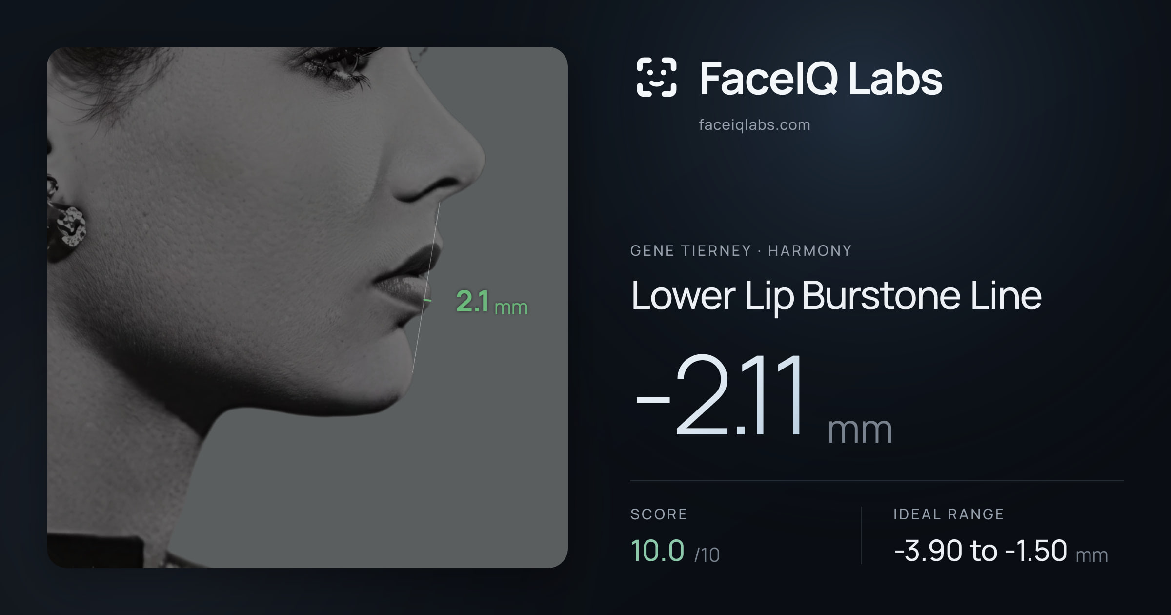Gene Tierney Lower Lip Burstone Line: -2.11mm, drawn on the photo
