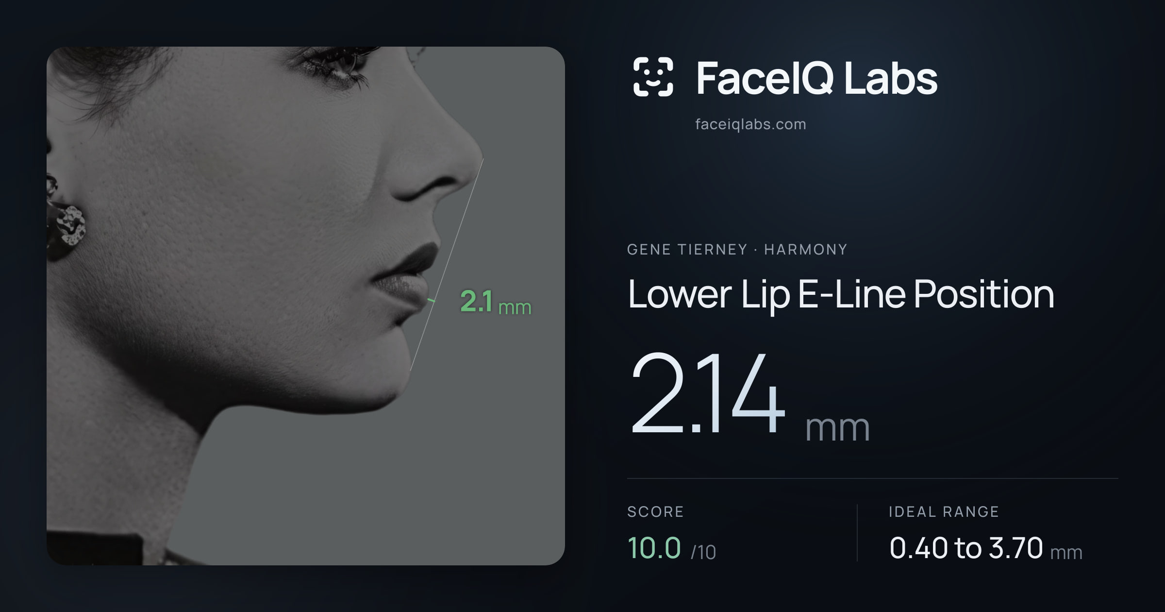Gene Tierney Lower Lip E-Line Position: 2.14mm, drawn on the photo