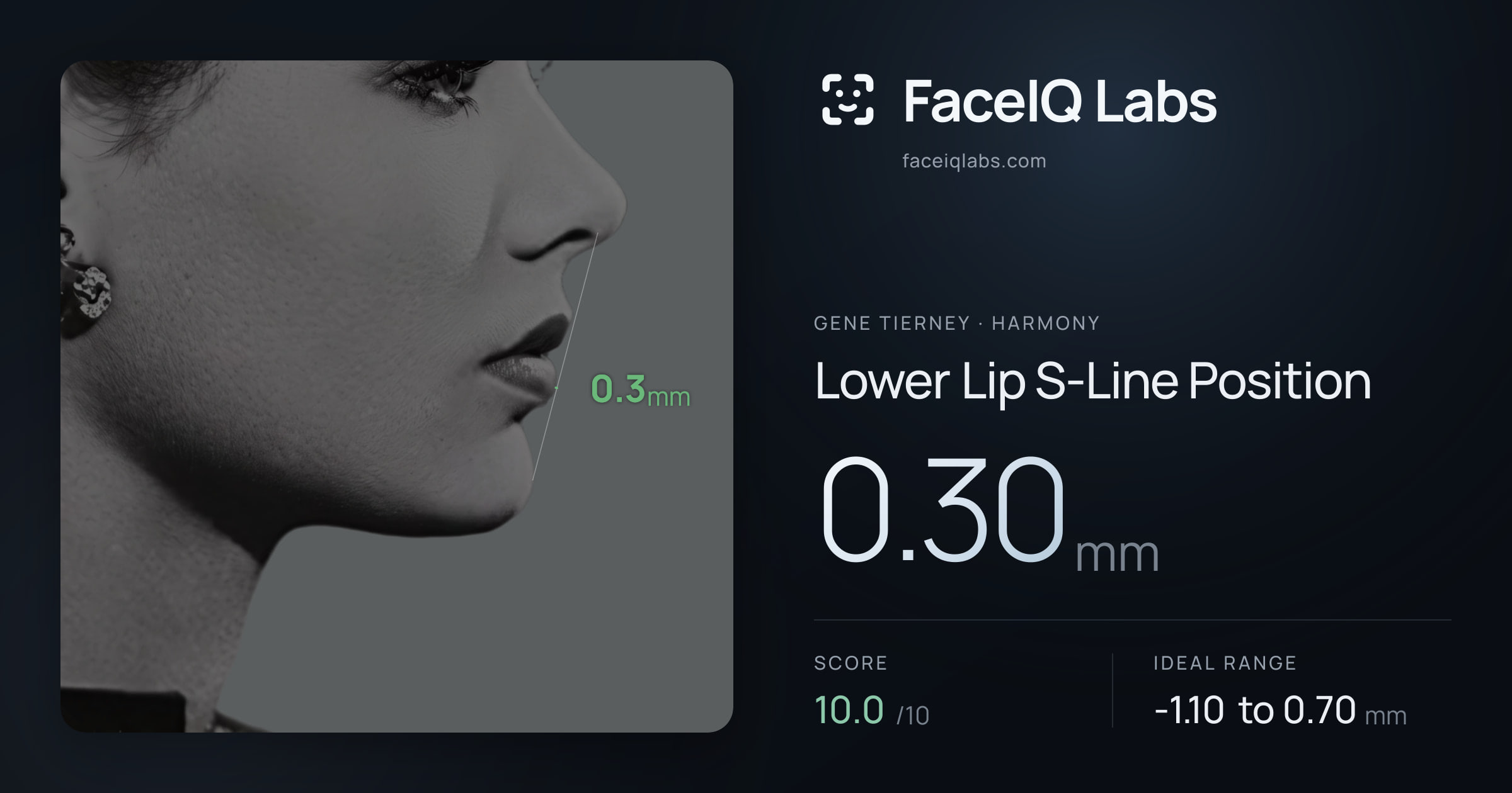 Gene Tierney Lower Lip S-Line Position: 0.30mm, drawn on the photo