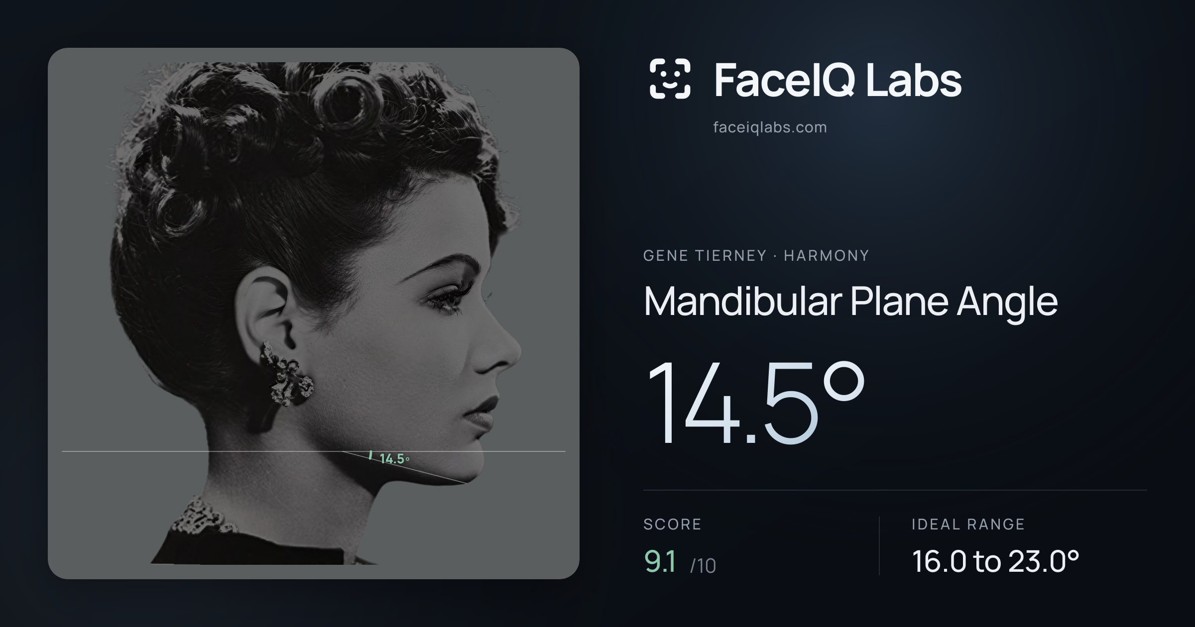 Gene Tierney Mandibular Plane Angle: 14.5°, drawn on the photo