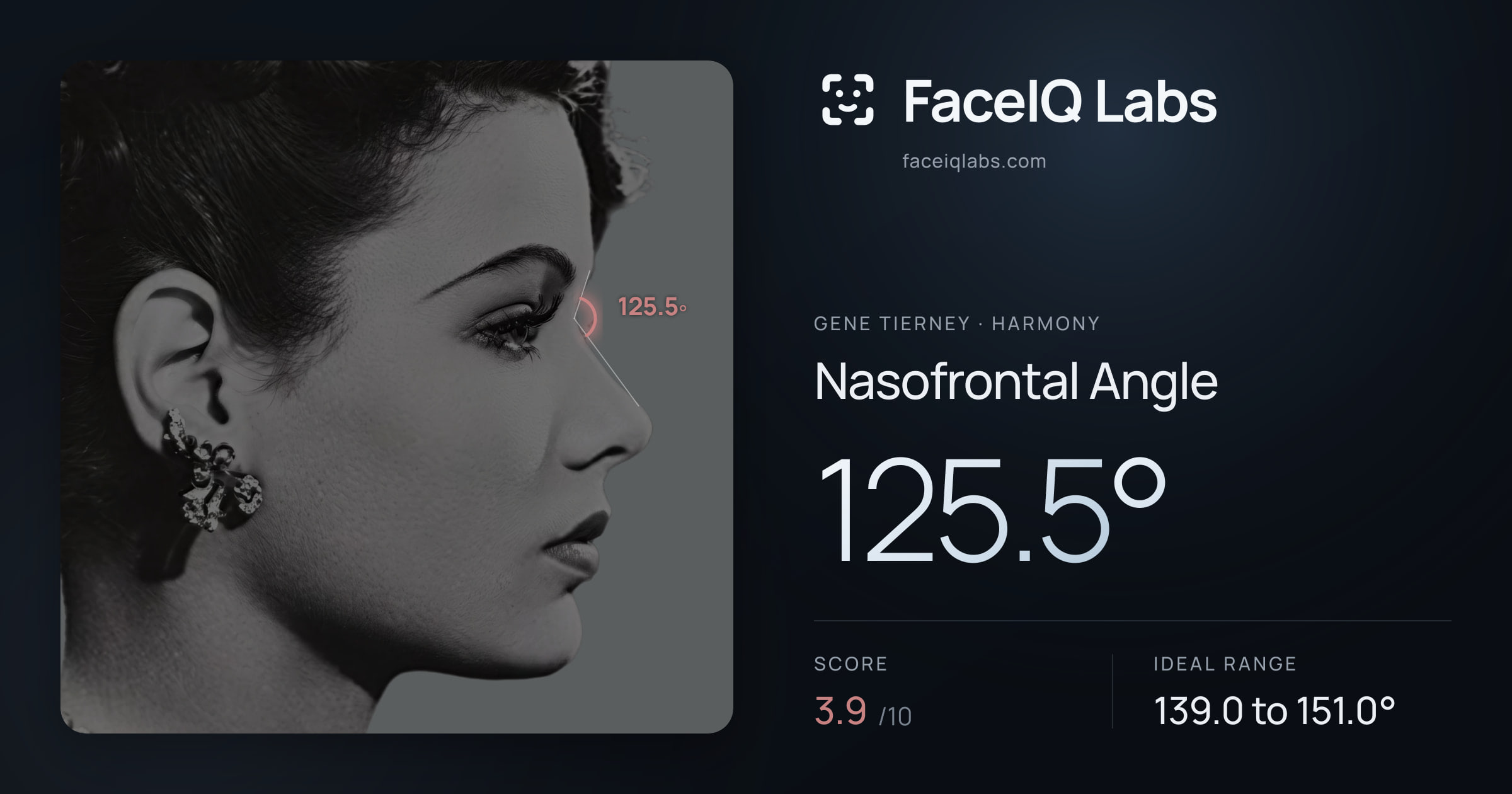 Gene Tierney Nasofrontal Angle: 125.5°, drawn on the photo