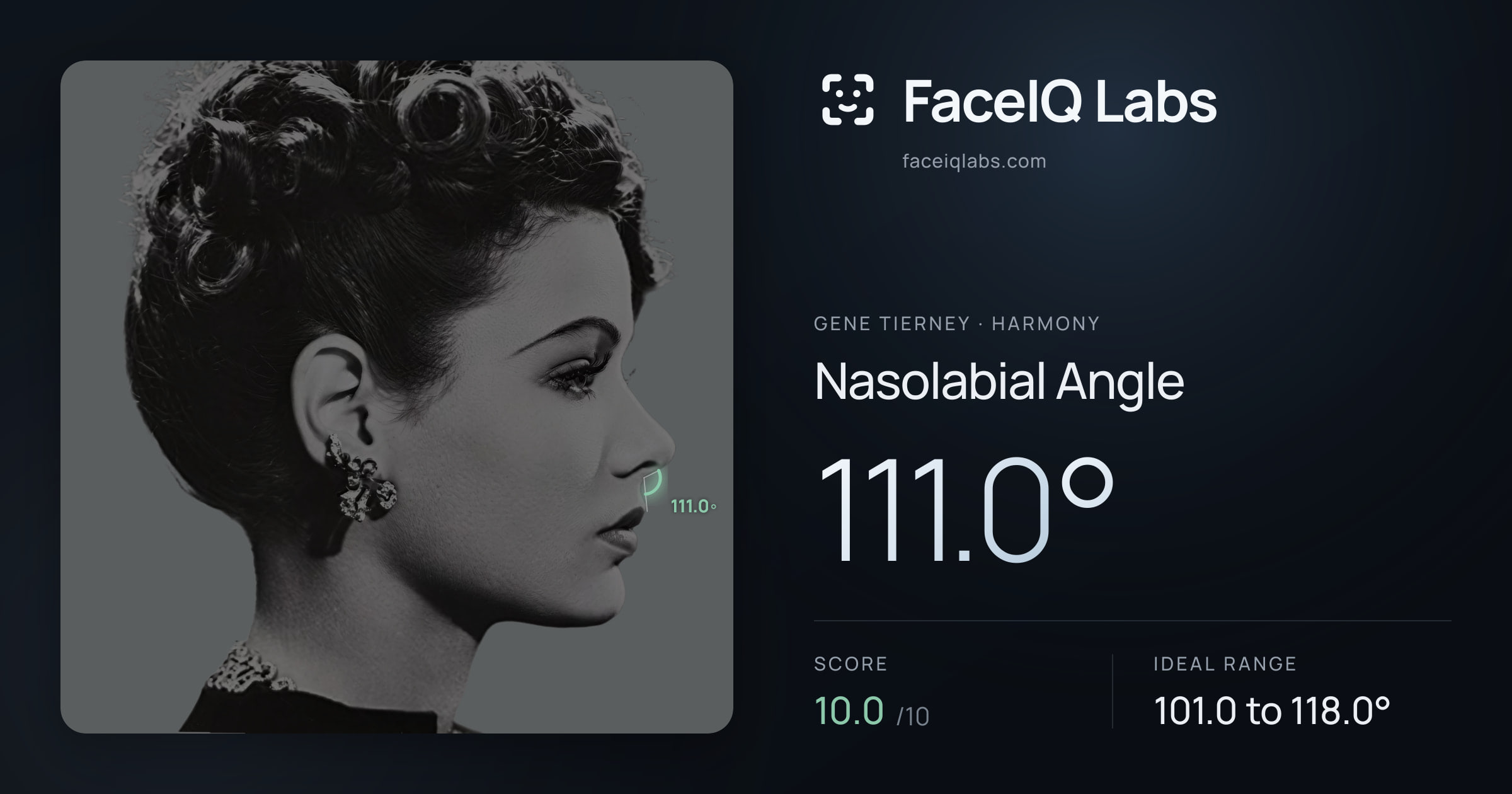 Gene Tierney Nasolabial Angle: 111.0°, drawn on the photo