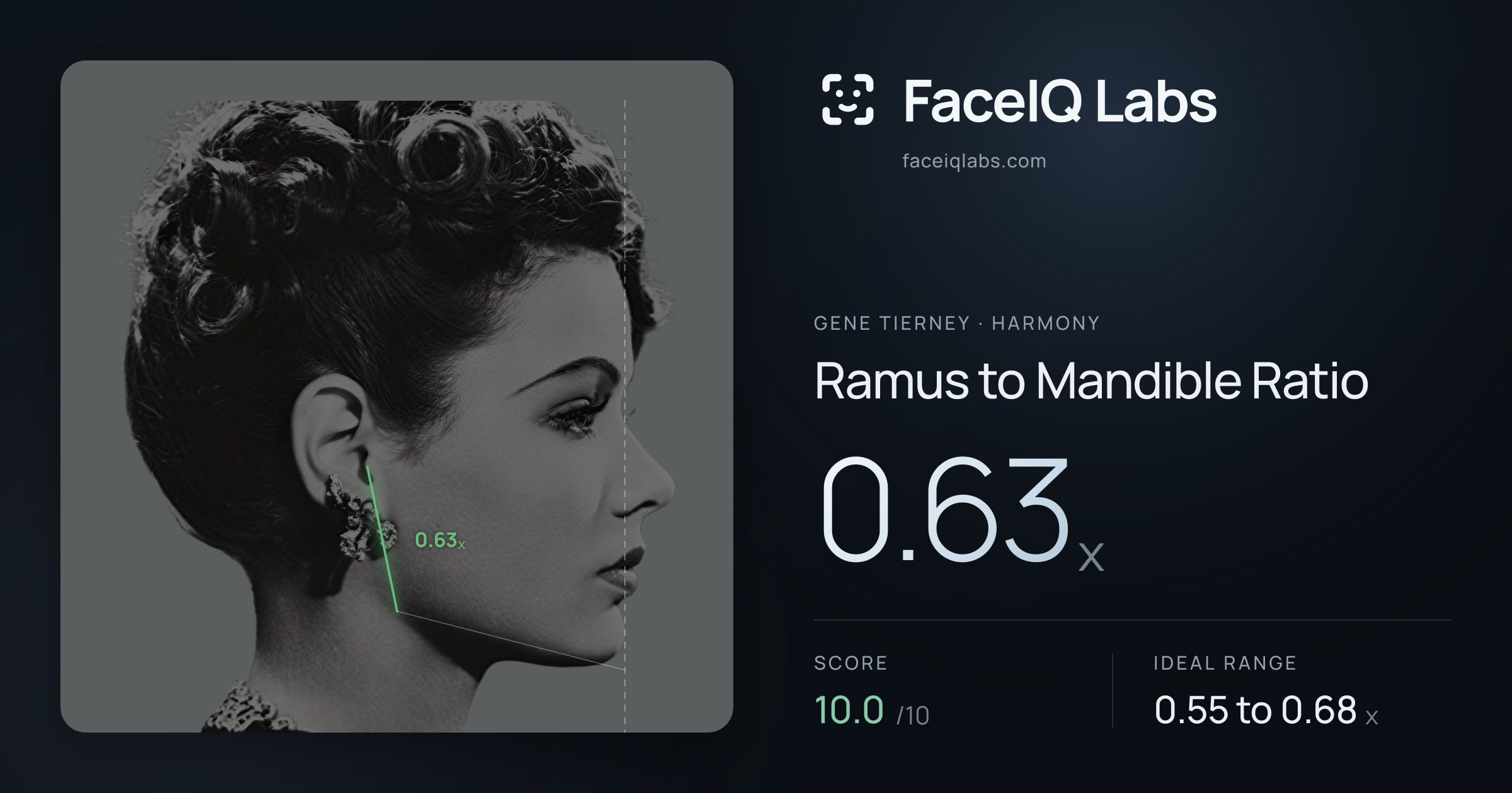 Gene Tierney Ramus to Mandible Ratio: 0.63x, drawn on the photo