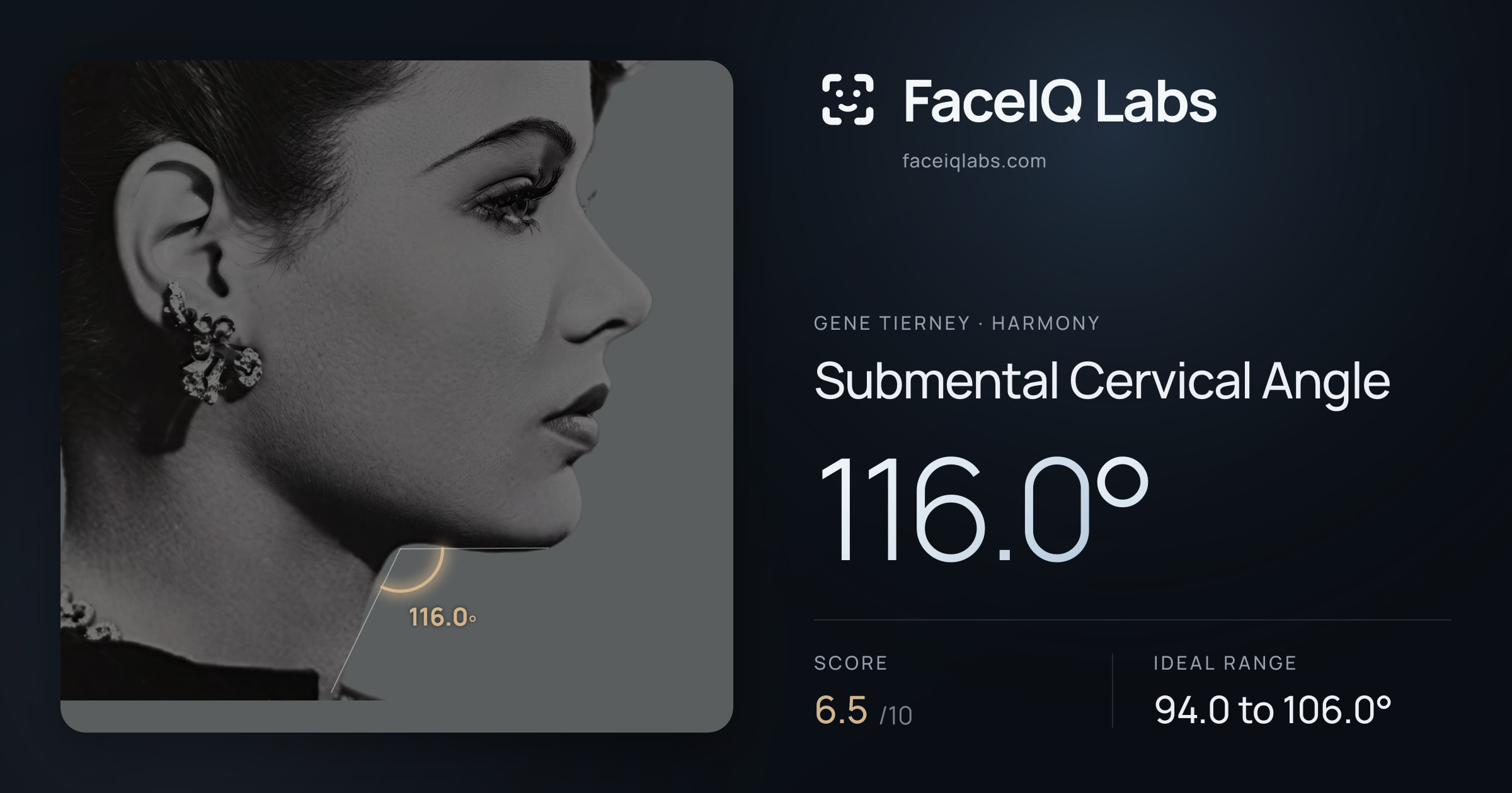 Gene Tierney Submental Cervical Angle: 116.0°, drawn on the photo