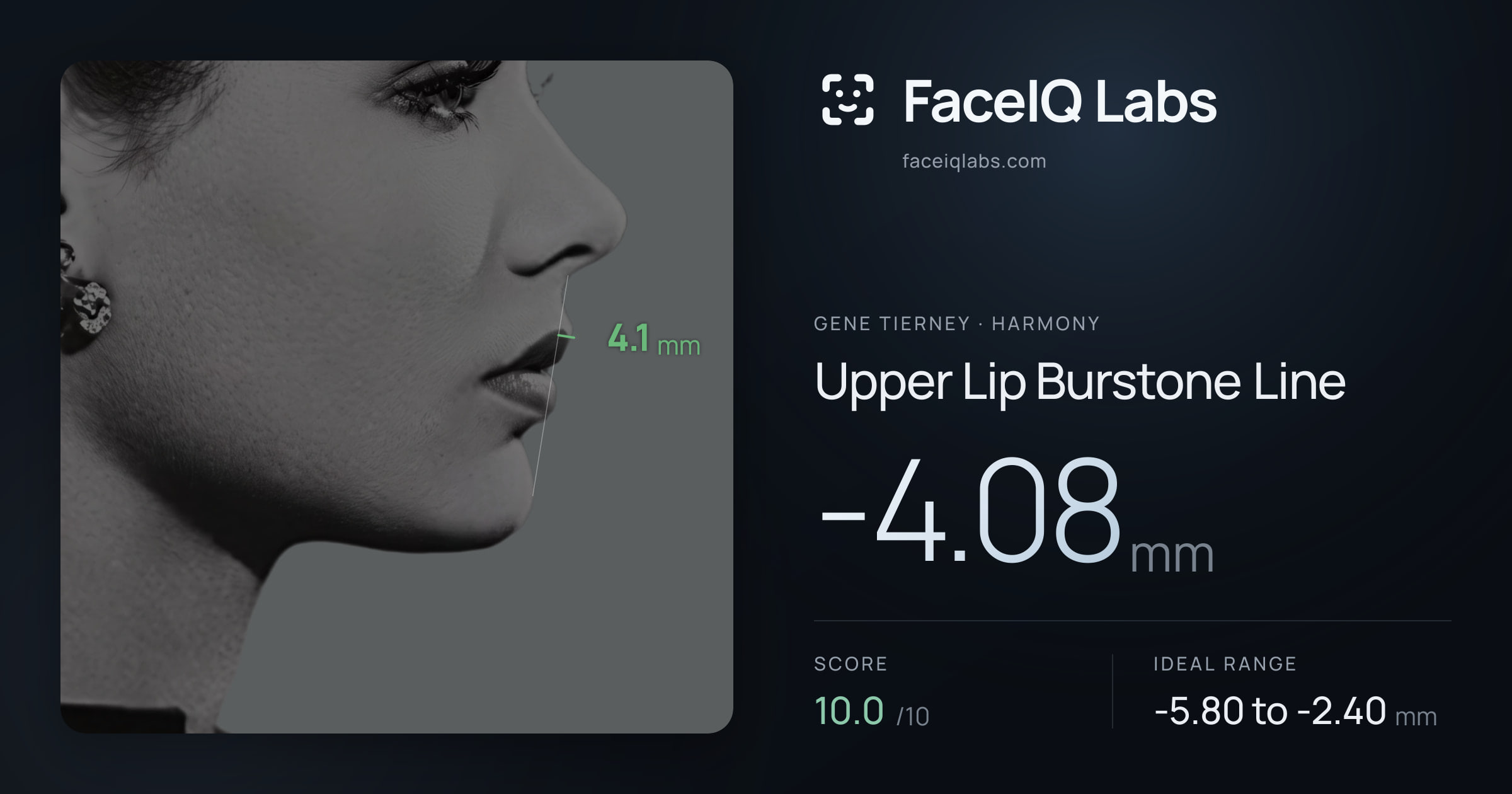Gene Tierney Upper Lip Burstone Line: -4.08mm, drawn on the photo