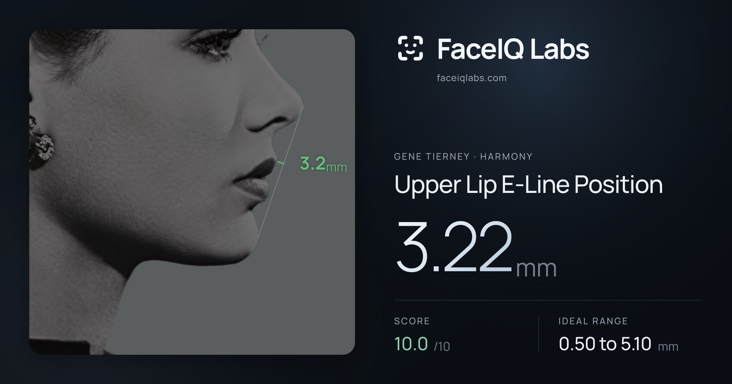 Gene Tierney Upper Lip E-Line Position: 3.22mm, drawn on the photo