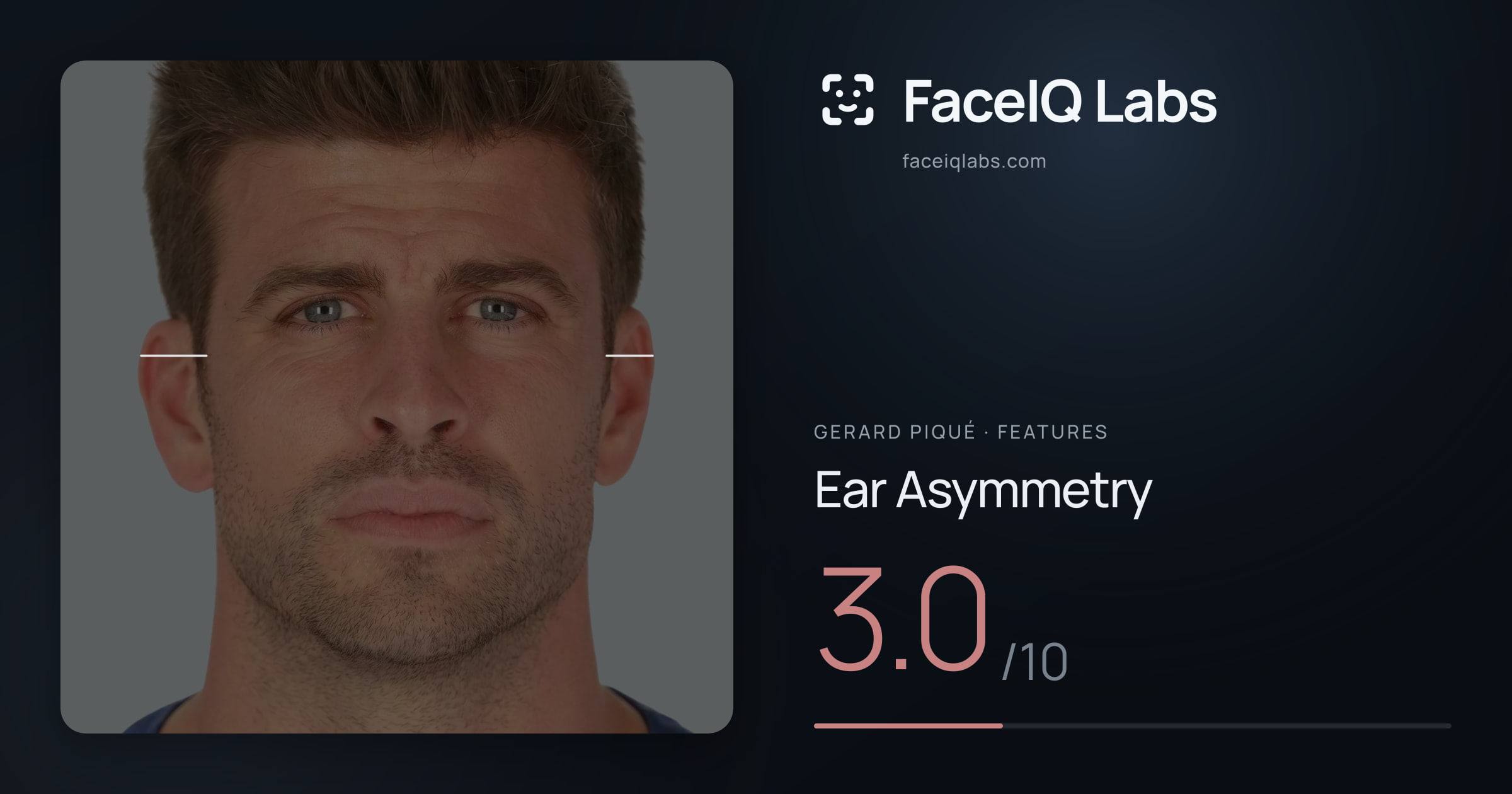 Gerard Piqué Ear Asymmetry: 3.0/10, drawn on the photo