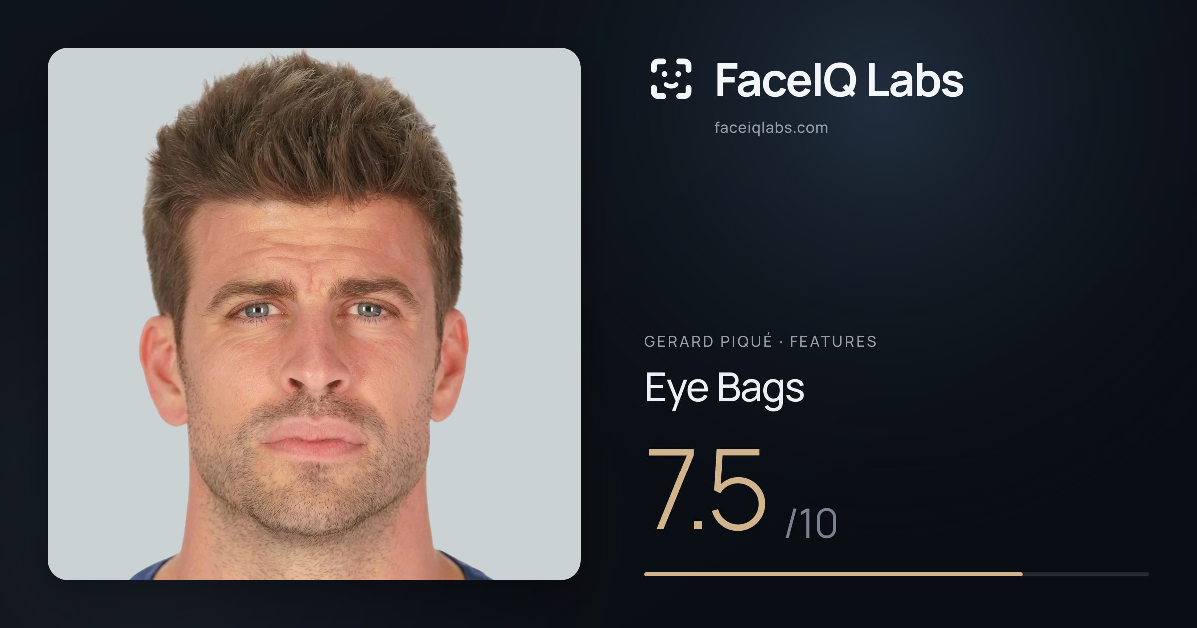 Gerard Piqué Eye Bags: 7.5/10, drawn on the photo