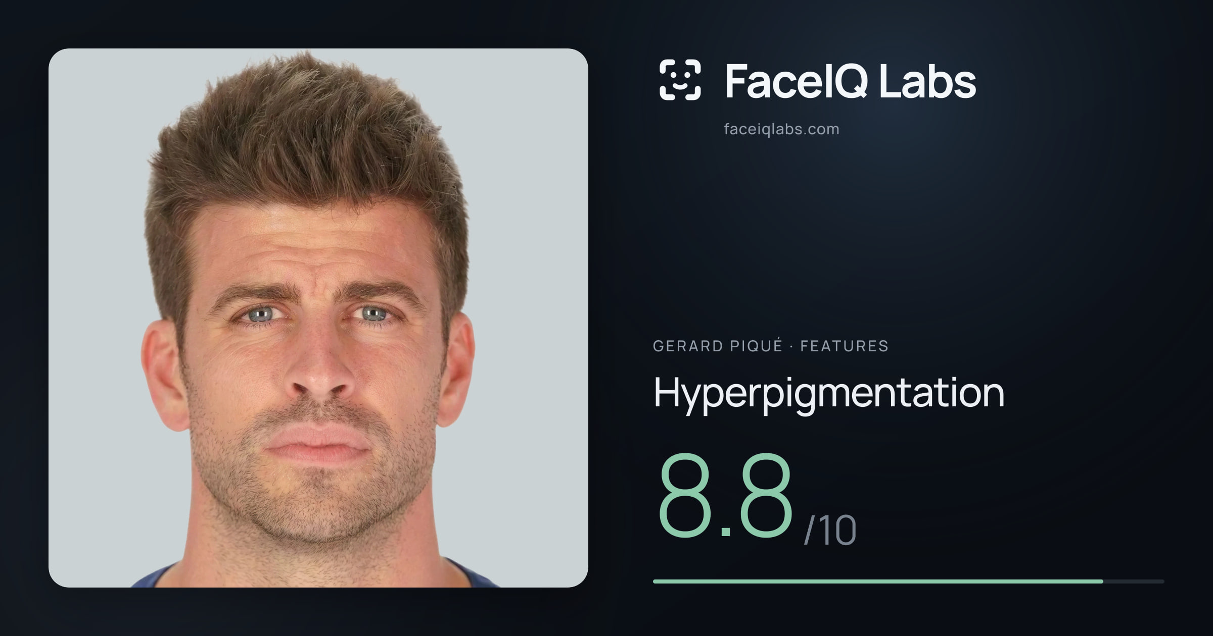 Gerard Piqué Hyperpigmentation: 8.8/10, drawn on the photo