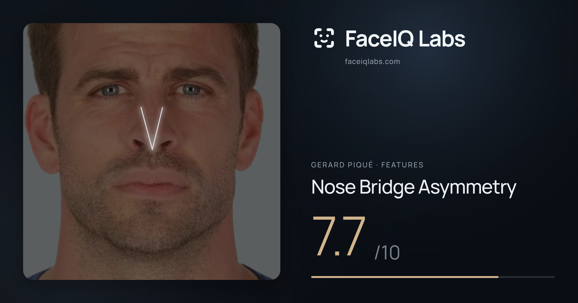 Gerard Piqué Nose Bridge Asymmetry: 7.7/10, drawn on the photo