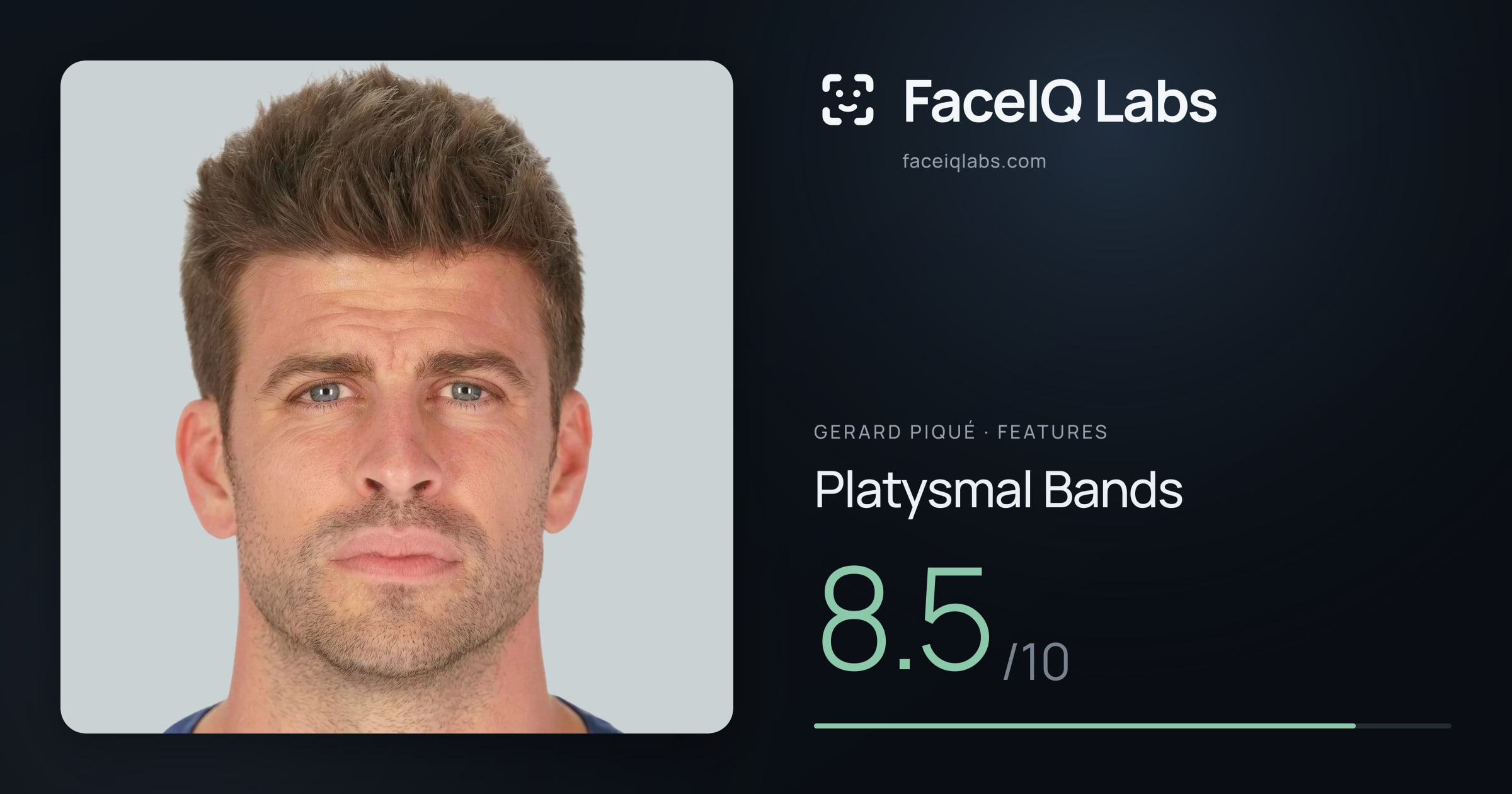 Gerard Piqué Platysmal Bands: 8.5/10, drawn on the photo
