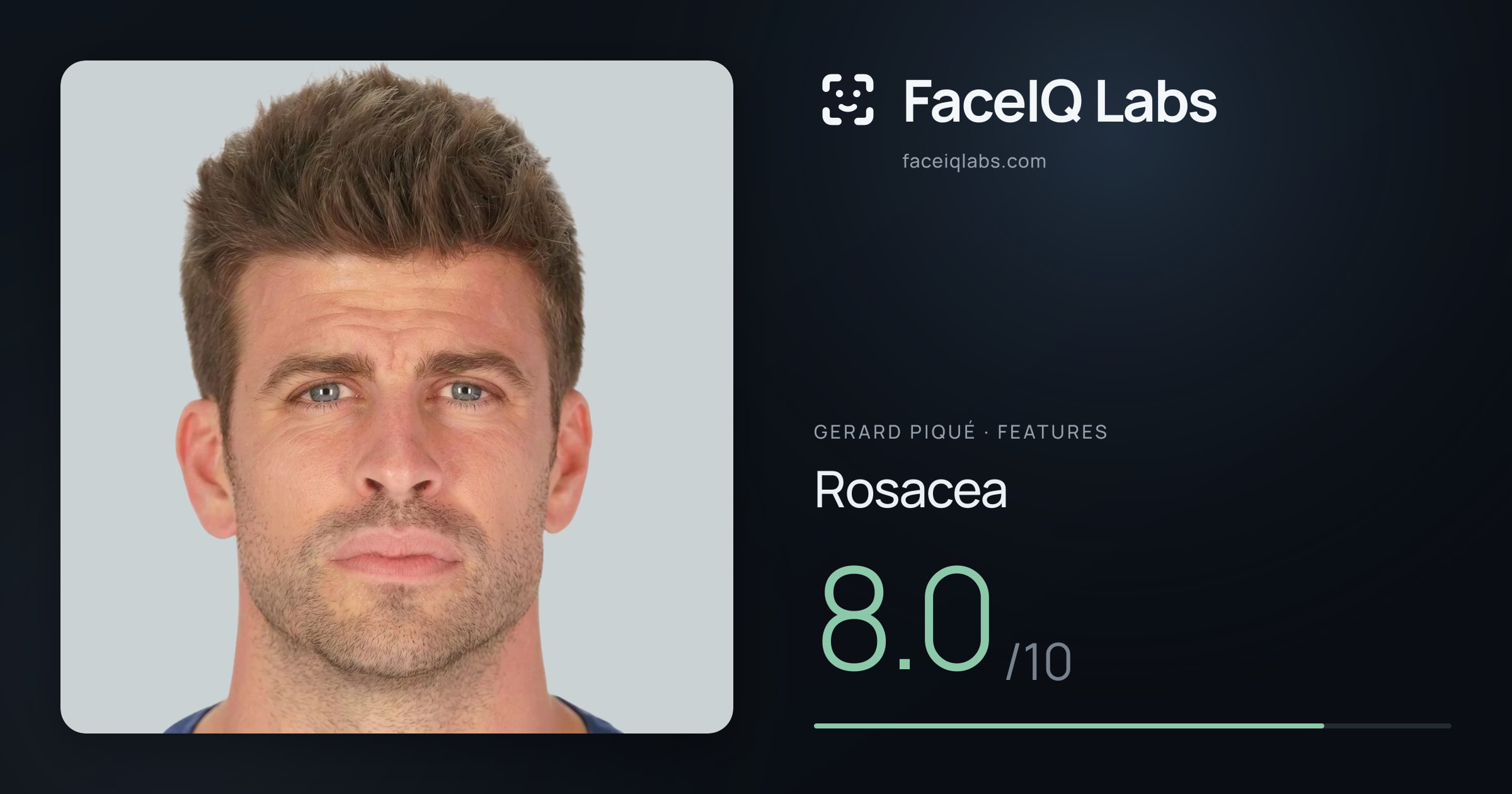 Gerard Piqué Rosacea: 8.0/10, drawn on the photo