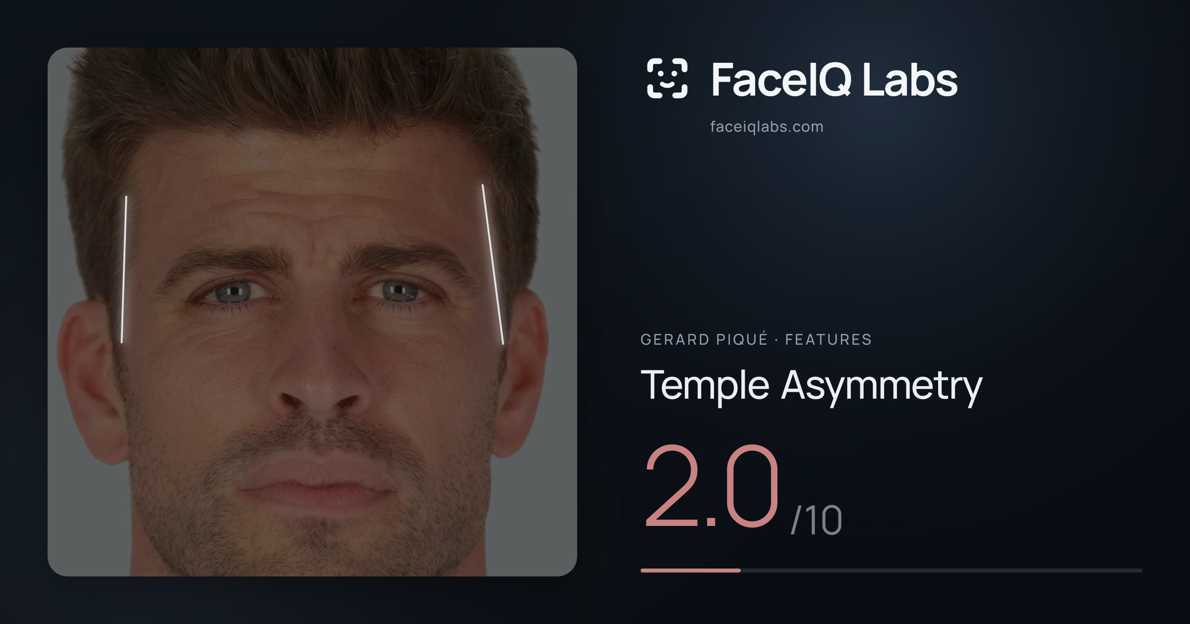 Gerard Piqué Temple Asymmetry: 2.0/10, drawn on the photo