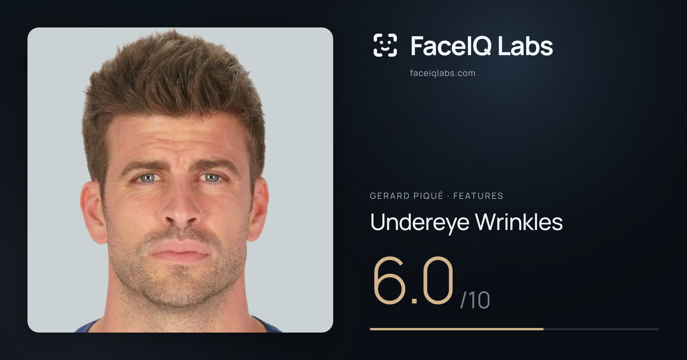 Gerard Piqué Undereye Wrinkles: 6.0/10, drawn on the photo