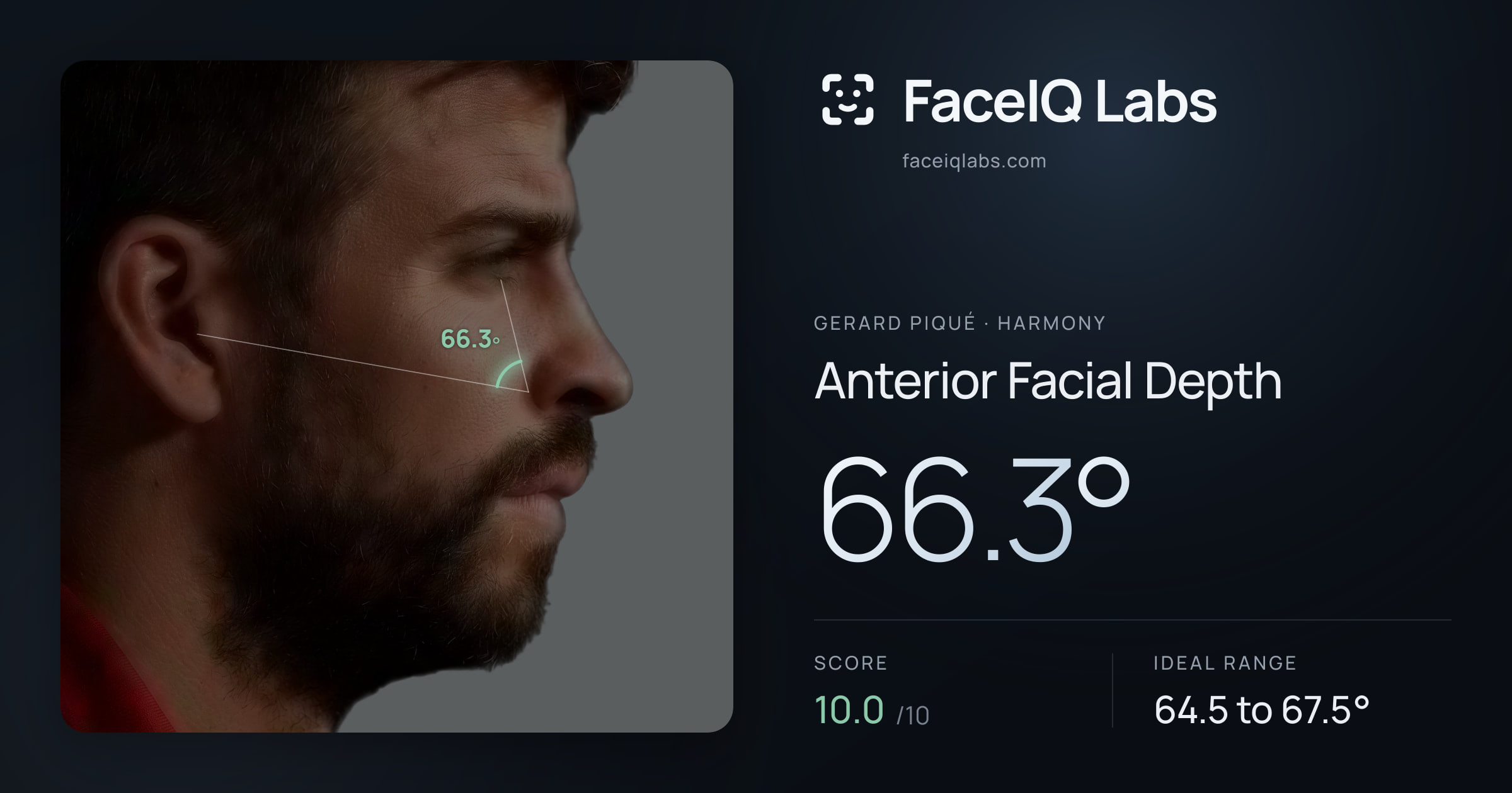 Gerard Piqué Anterior Facial Depth: 66.3°, drawn on the photo