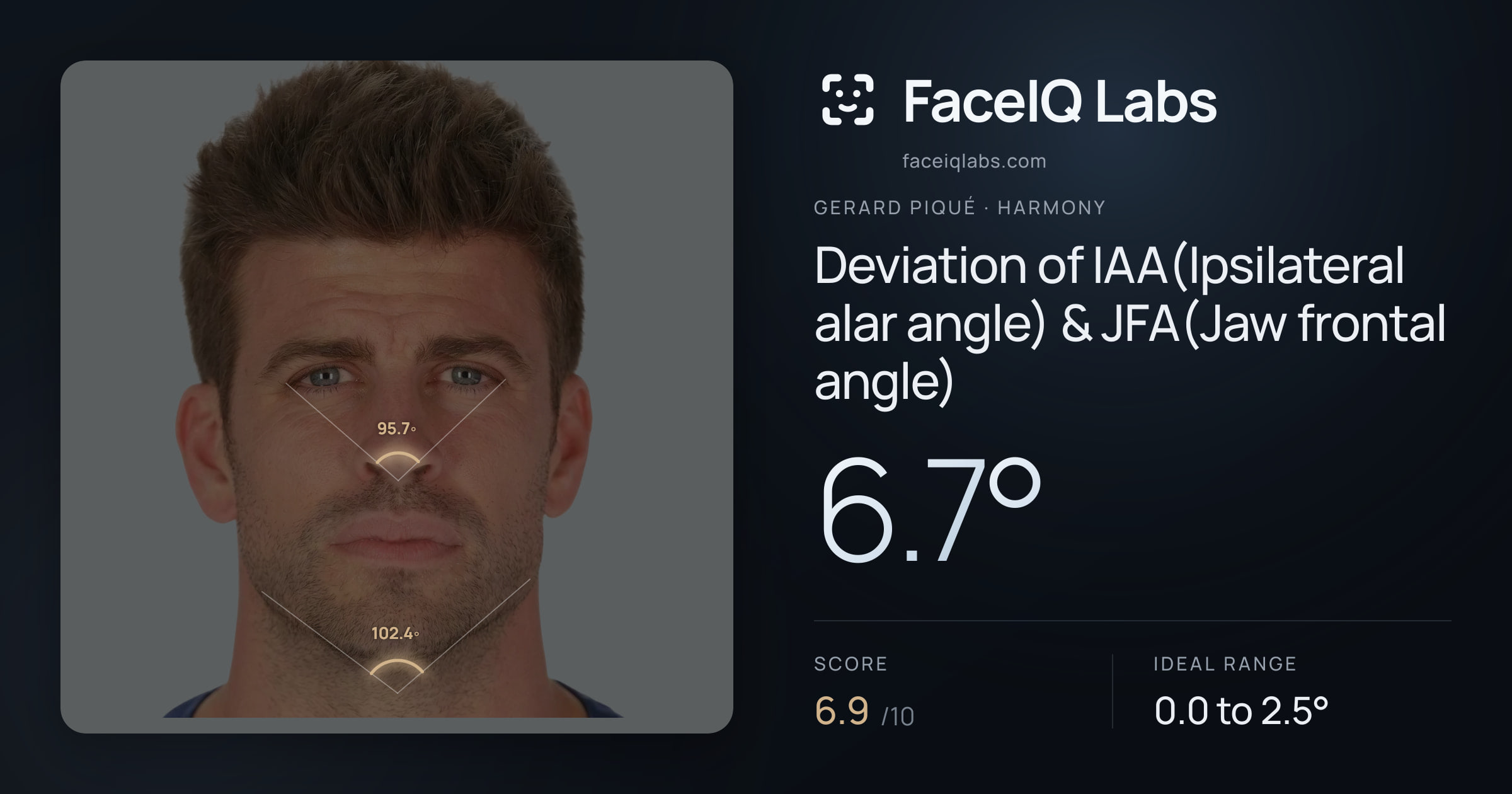 Gerard Piqué Deviation of IAA(Ipsilateral alar angle) & JFA(Jaw frontal angle): 6.7°, drawn on the photo