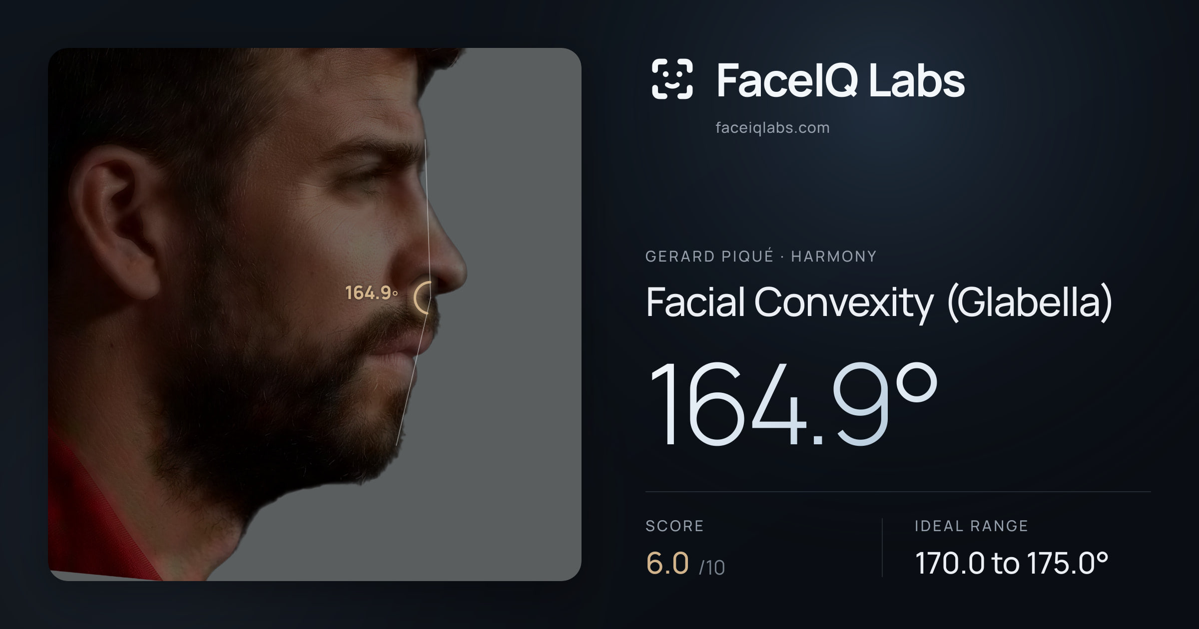 Gerard Piqué Facial Convexity (Glabella): 164.9°, drawn on the photo