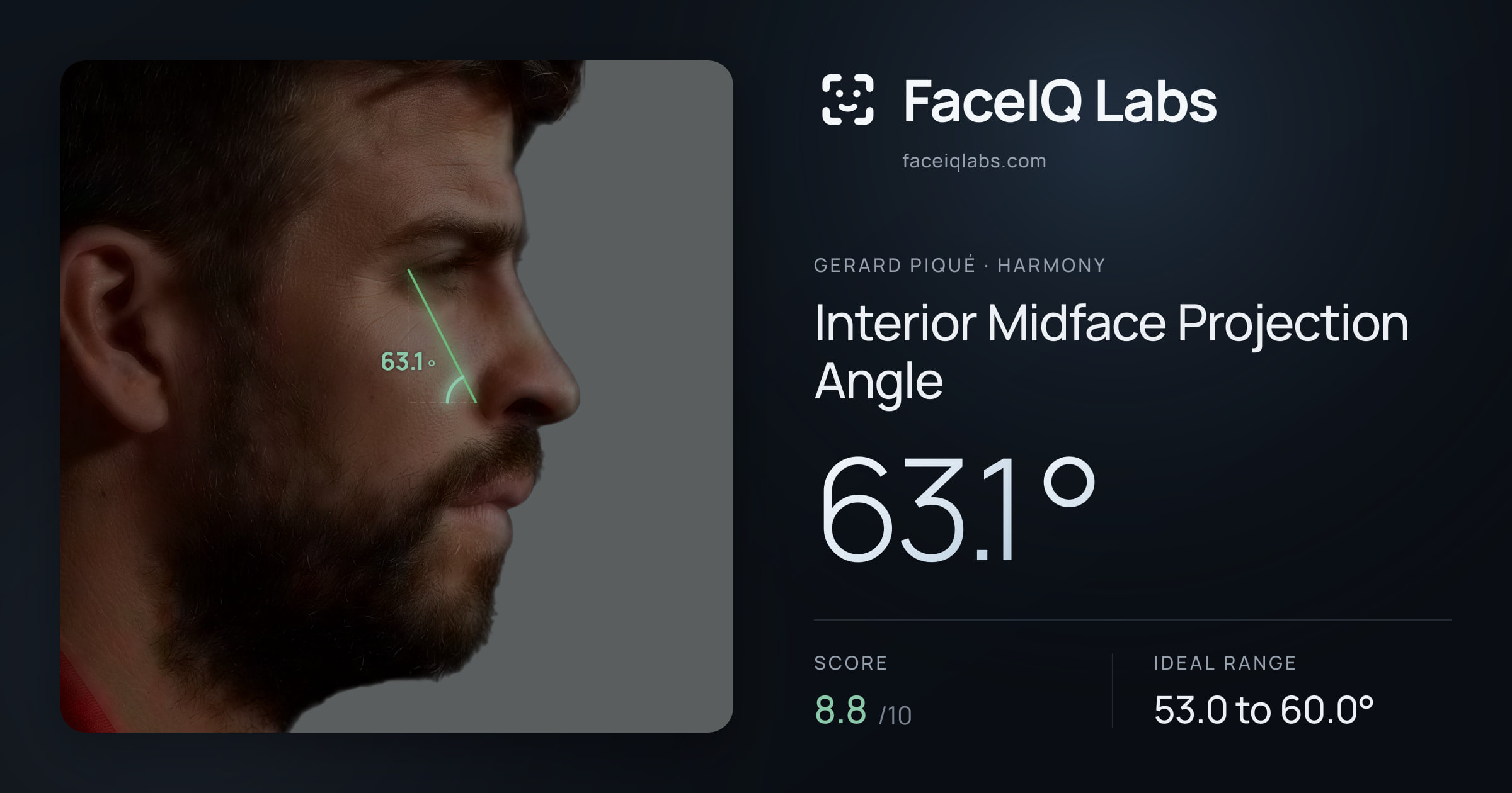 Gerard Piqué Interior Midface Projection Angle: 63.1°, drawn on the photo